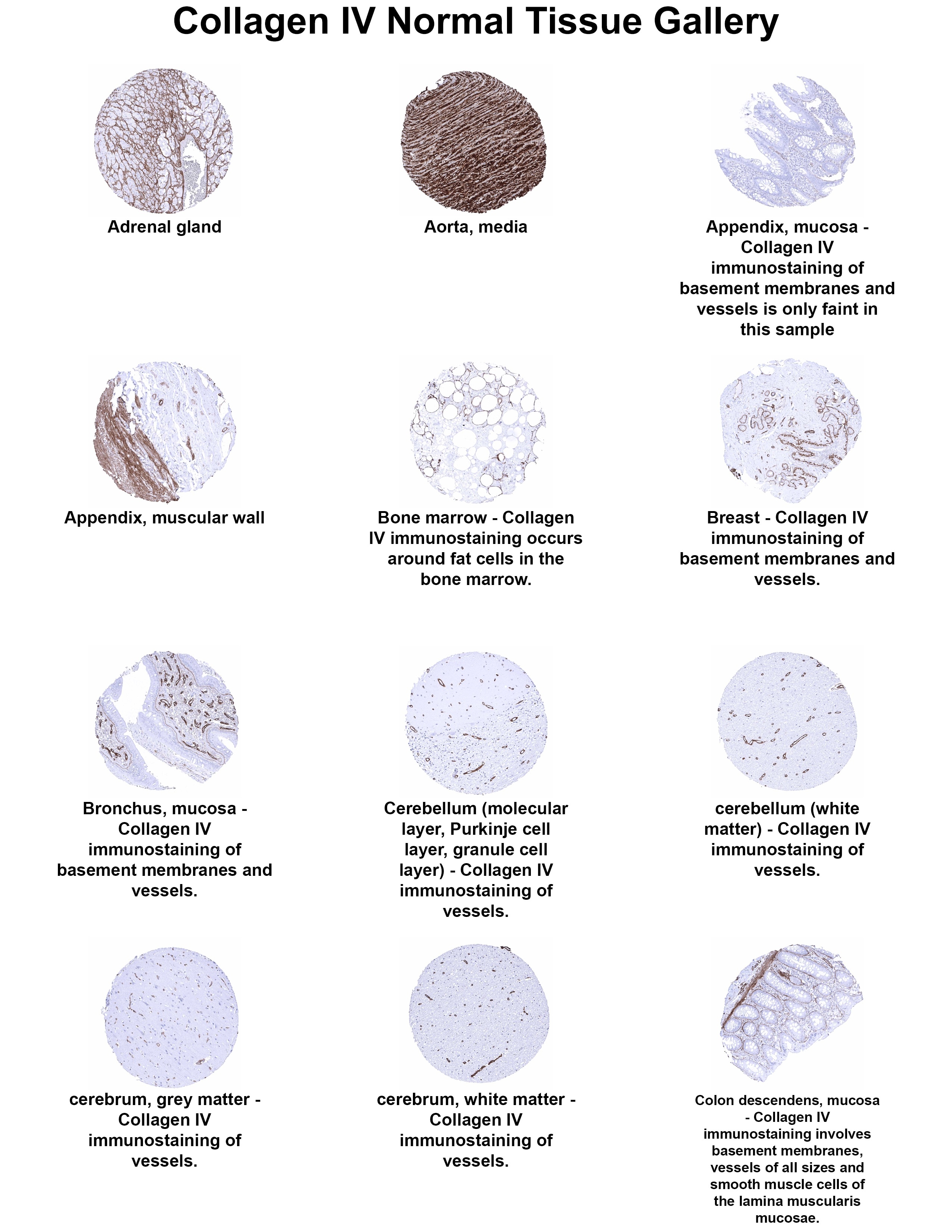 Collagen IV Antibody (MSVA-704R) - Azide and BSA Free Collagen IV Antibody (MSVA-704R) - Azide and BSA Free Collagen IV Normal Tissue Gallery