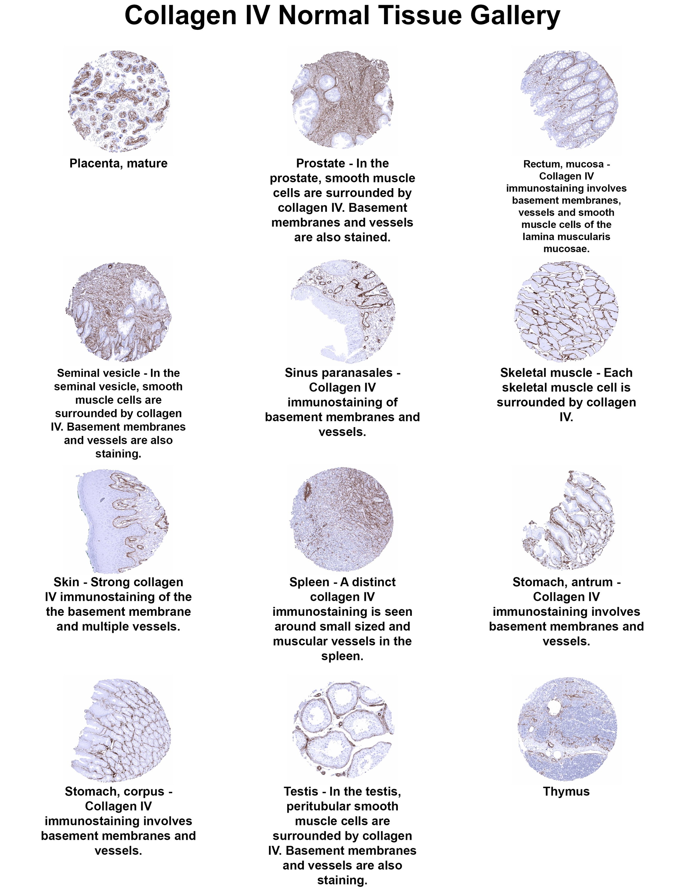 Collagen IV Antibody (MSVA-704R) - Azide and BSA Free Collagen IV Antibody (MSVA-704R) - Azide and BSA Free Collagen IV Normal Tissue Gallery