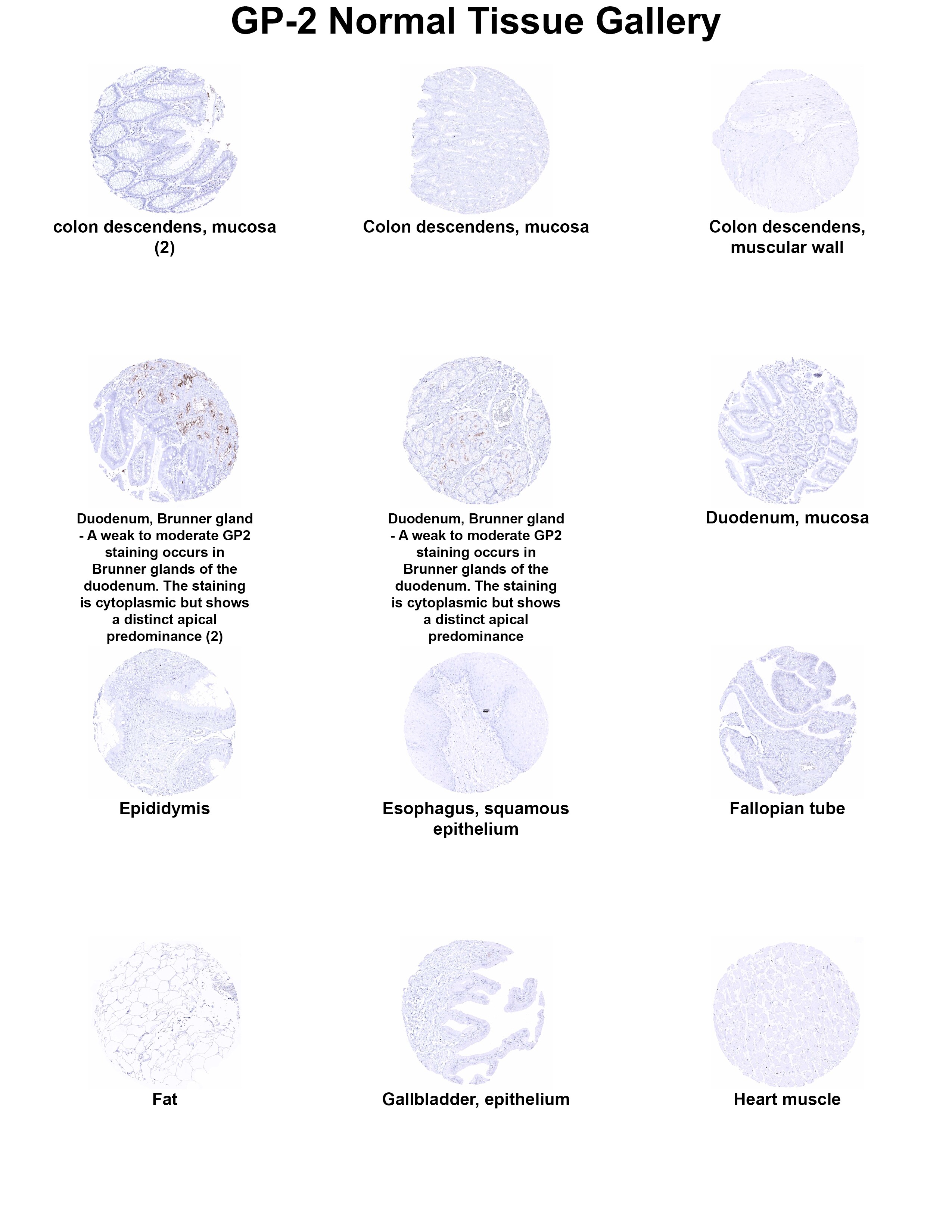 GP2 Antibody (MSVA-475M) - Azide and BSA Free GP2 Antibody (MSVA-475M) - Azide and BSA Free GP2 Normal Tissue Gallery