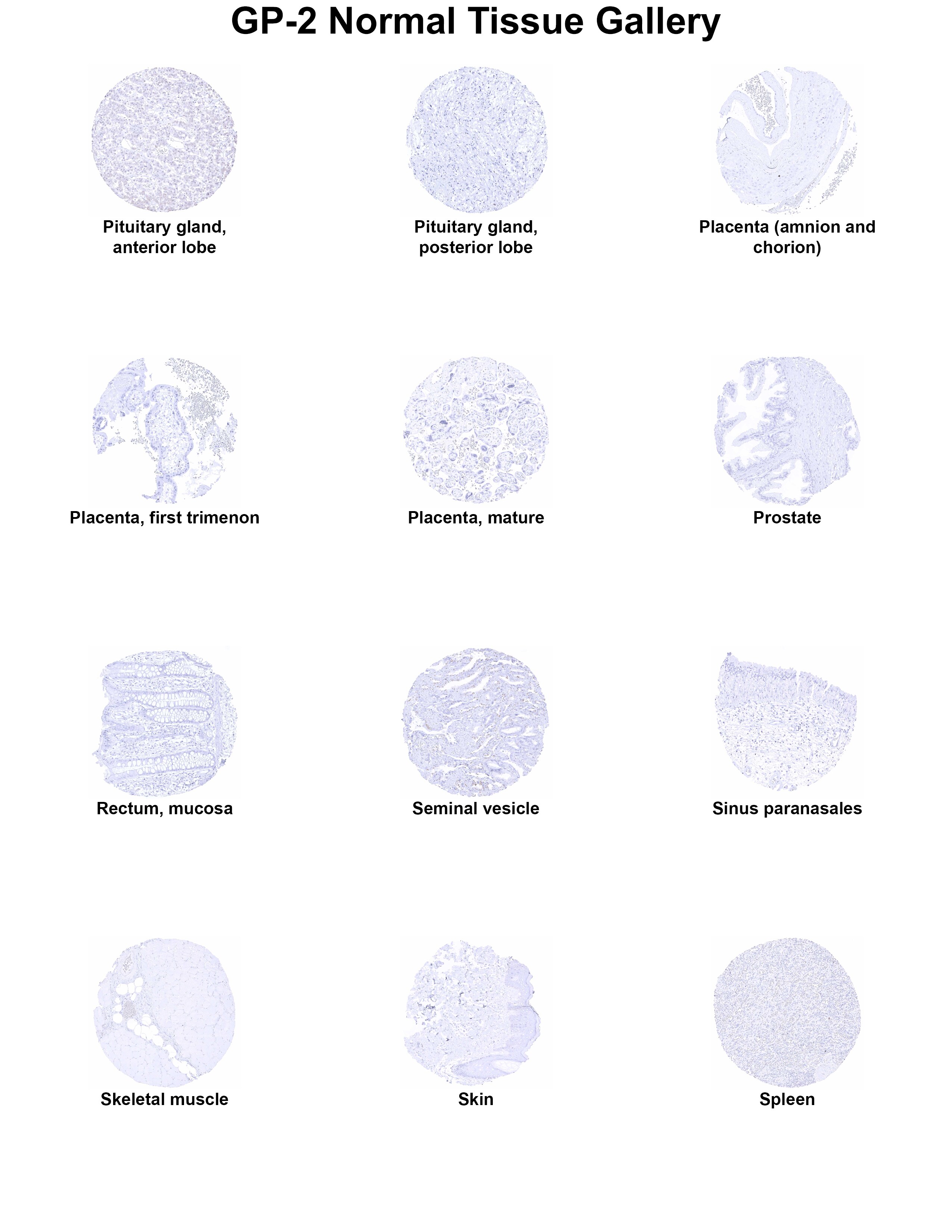 GP2 Antibody (MSVA-475M) - Azide and BSA Free GP2 Antibody (MSVA-475M) - Azide and BSA Free GP2 Normal Tissue Gallery