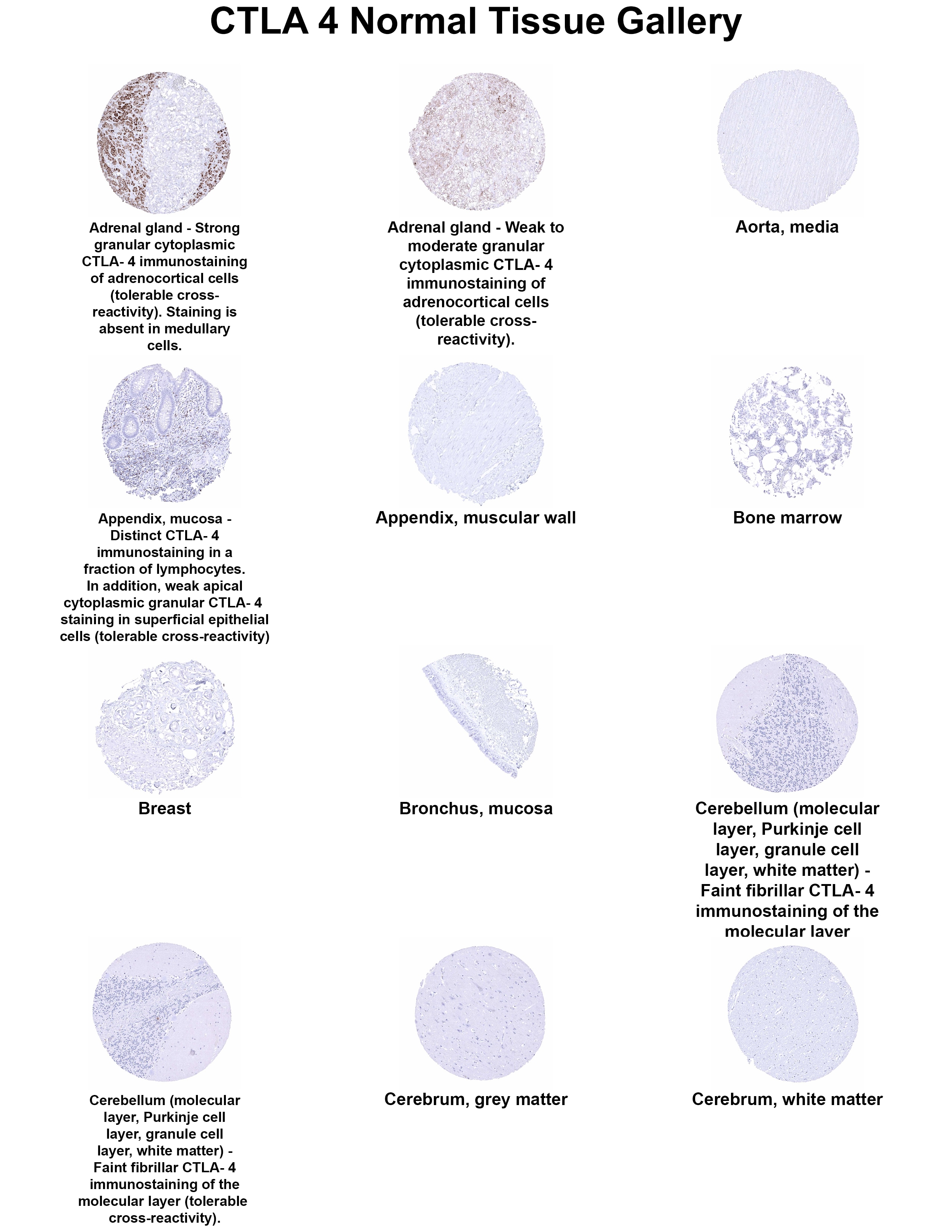 CTLA-4 Antibody (MSVA-152R) - Azide and BSA Free CTLA-4 Antibody (MSVA-152R) - Azide and BSA Free CTLA-4 Normal Tissue Gallery