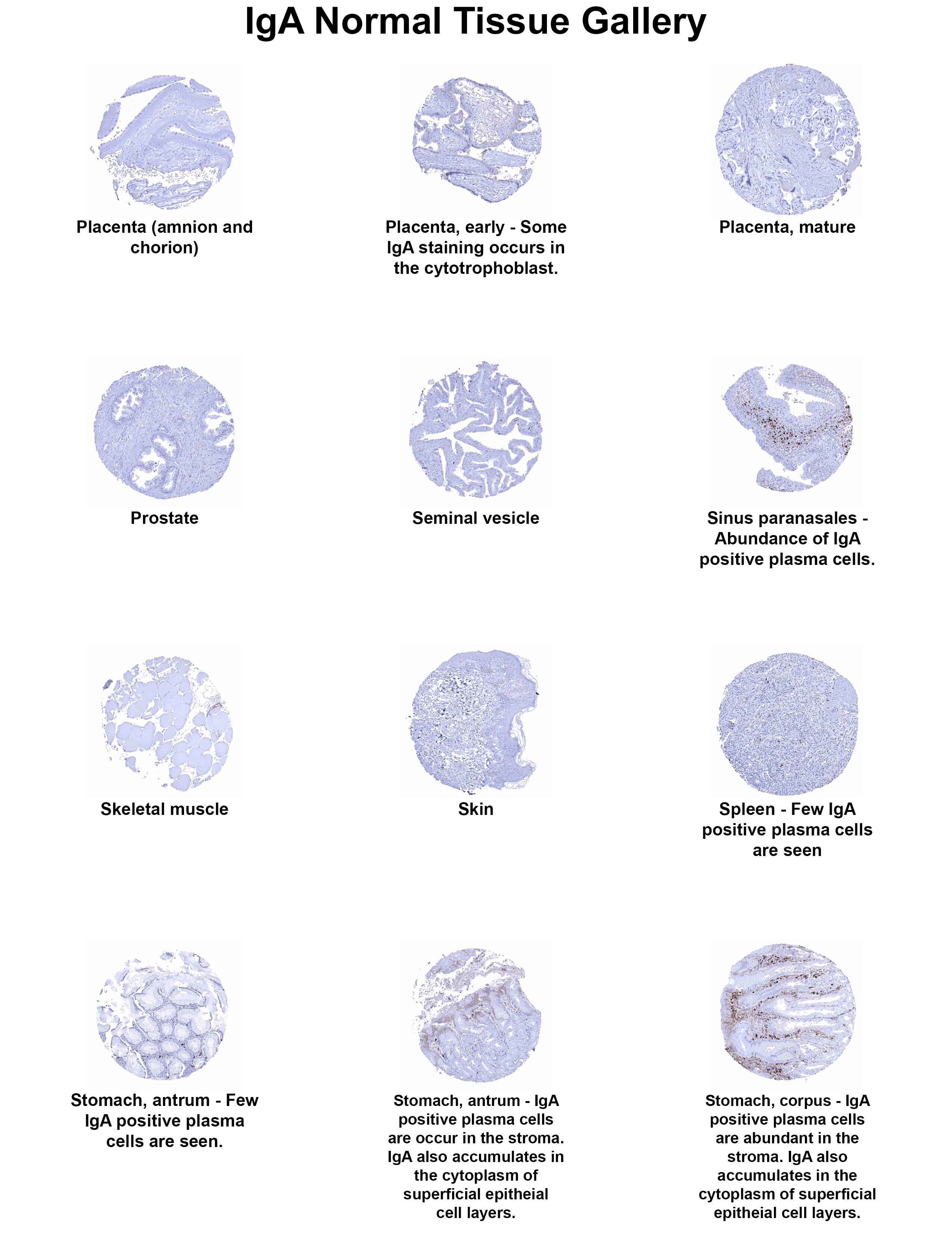 IgA Antibody (MSVA-700R) - Azide and BSA Free IgA Antibody (MSVA-700R) - Azide and BSA Free IgA Normal Tissue Gallery