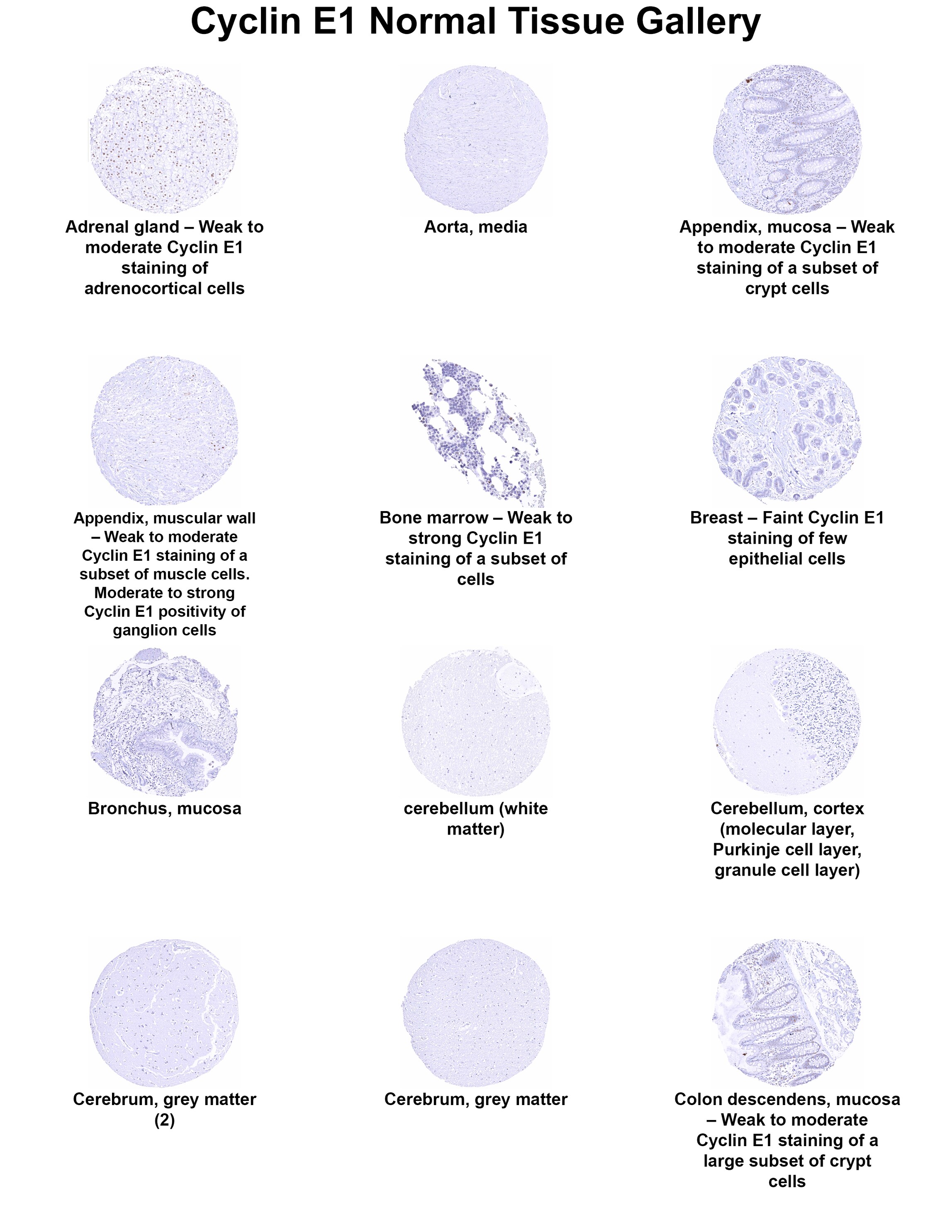 Cyclin E1 Antibody (MSVA-898R) - Azide and BSA Free Cyclin E1 Antibody (MSVA-898R) - Azide and BSA Free Cyclin E1 Normal Tissue Gallery