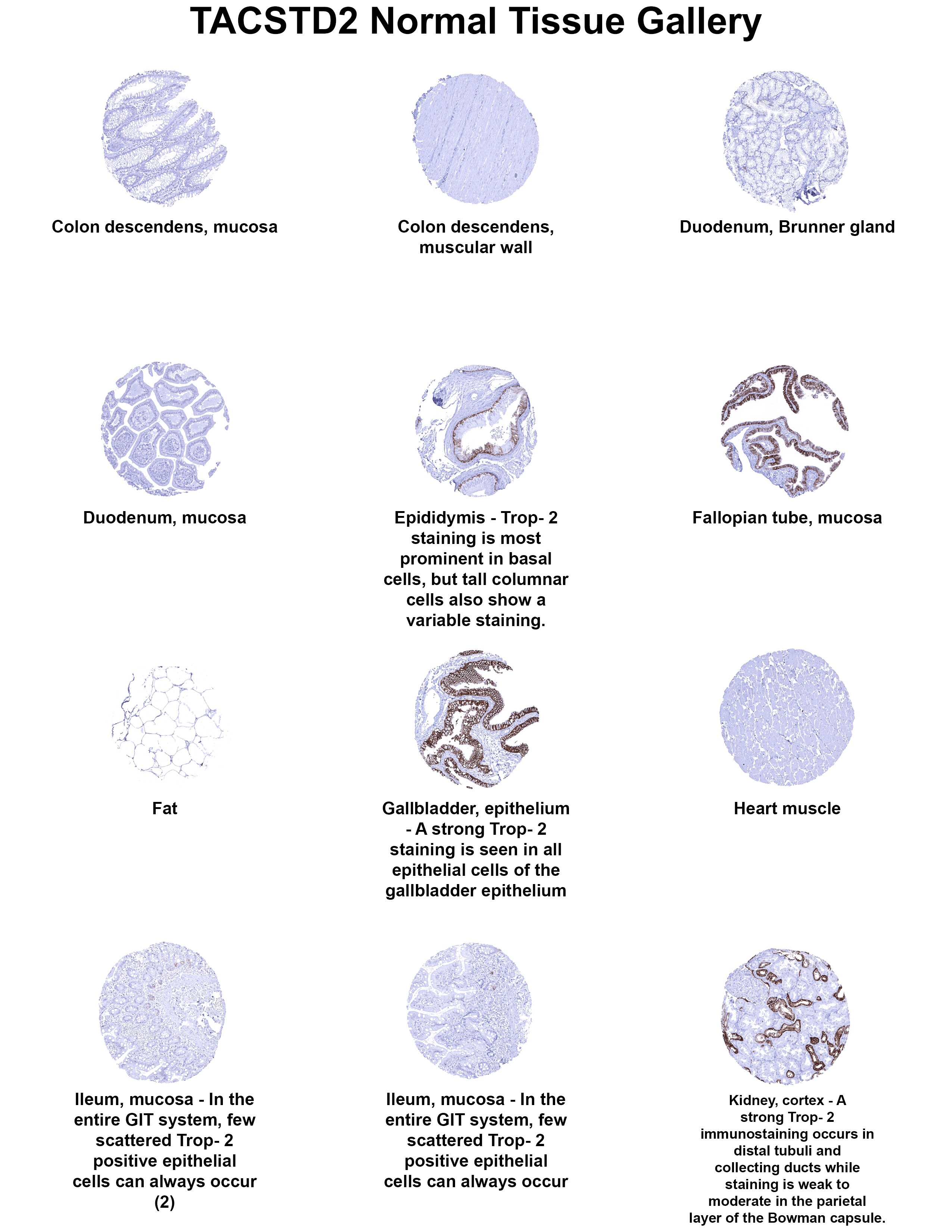 TROP-2 Antibody (MSVA-733R) - Azide and BSA Free TROP-2 Antibody (MSVA-733R) - Azide and BSA Free TROP-2 Normal Tissue Gallery
