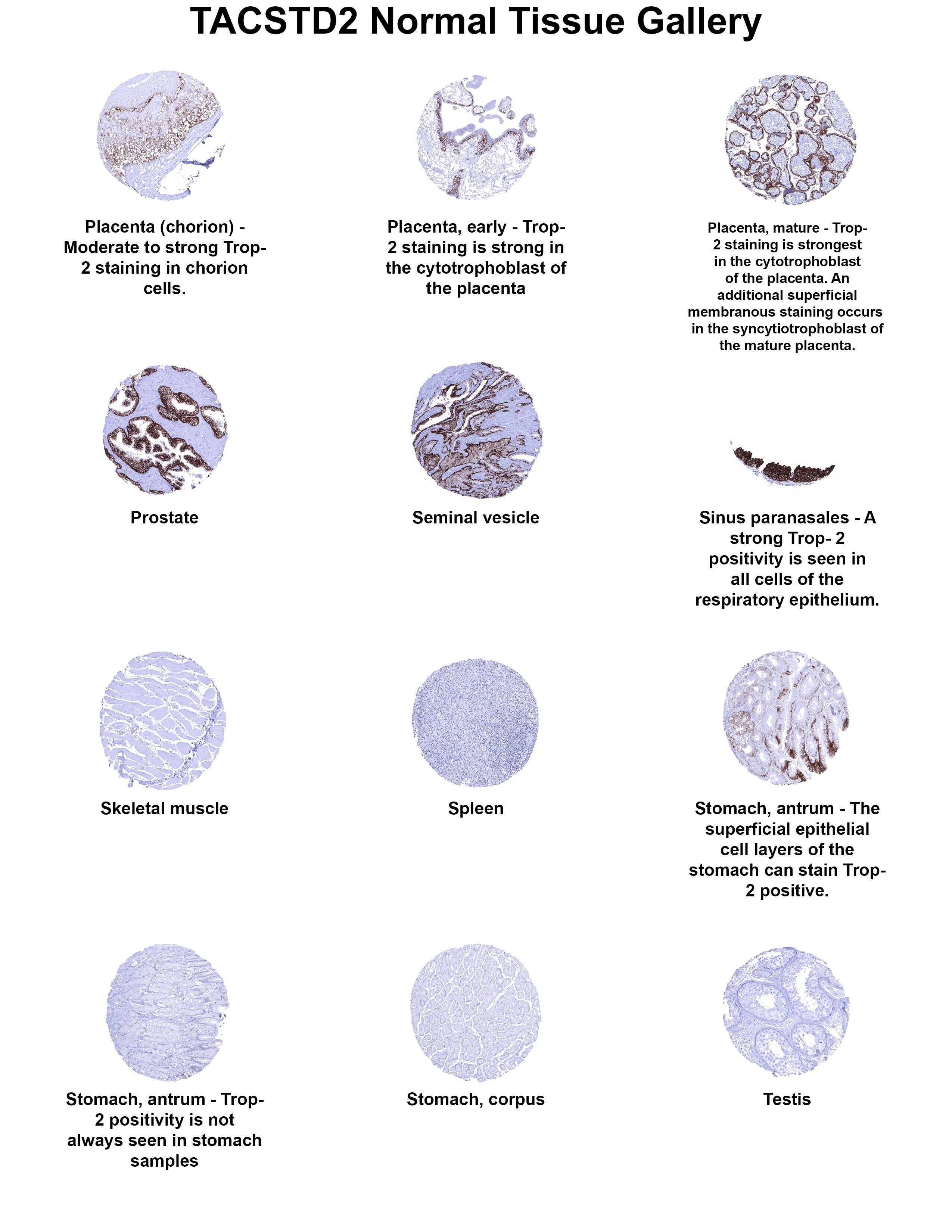 TROP-2 Antibody (MSVA-733R) - Azide and BSA Free TROP-2 Antibody (MSVA-733R) - Azide and BSA Free TROP-2 Normal Tissue Gallery