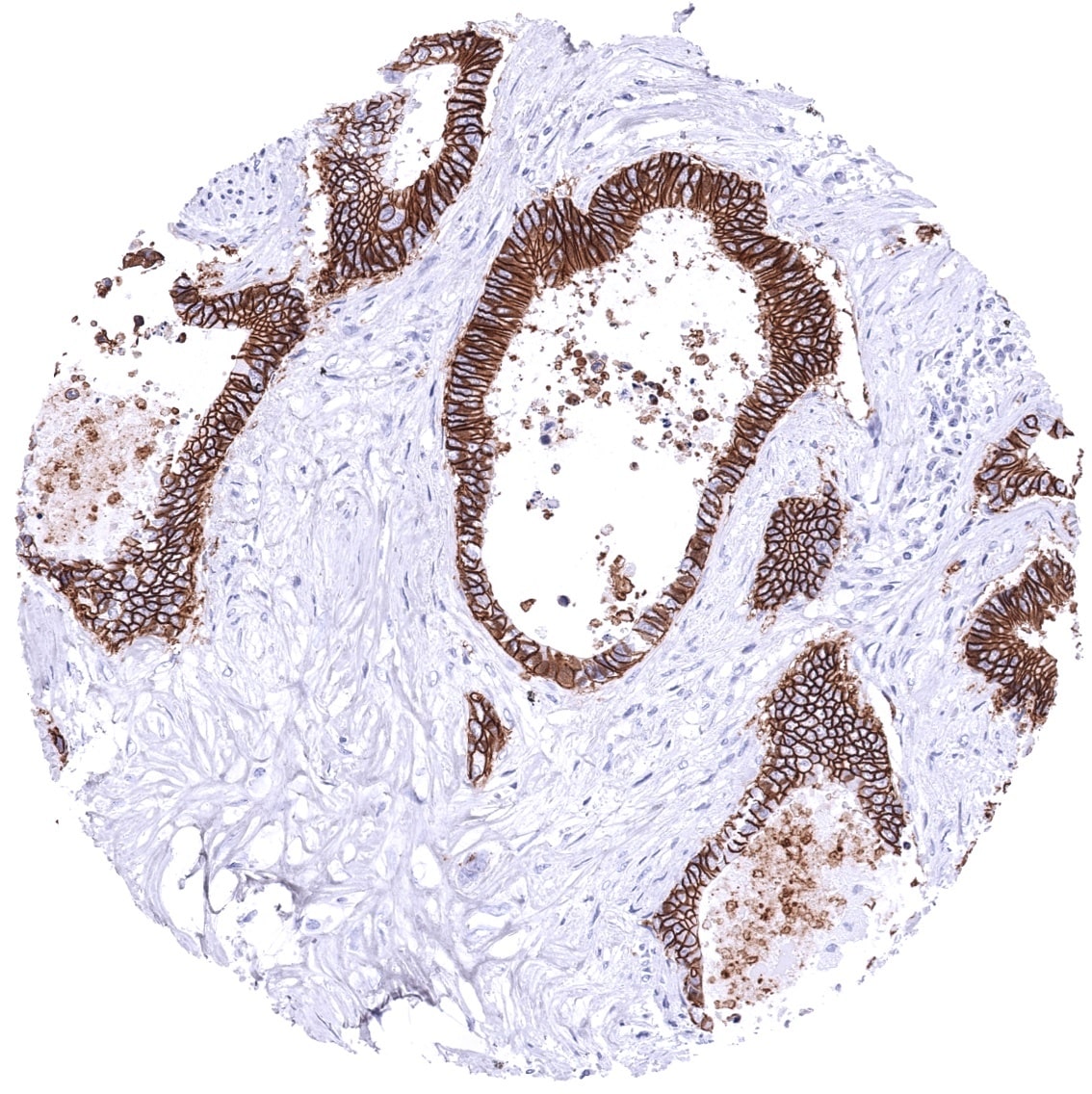 Cadherin-17 Antibody (MSVA-517M) - Azide and BSA Free