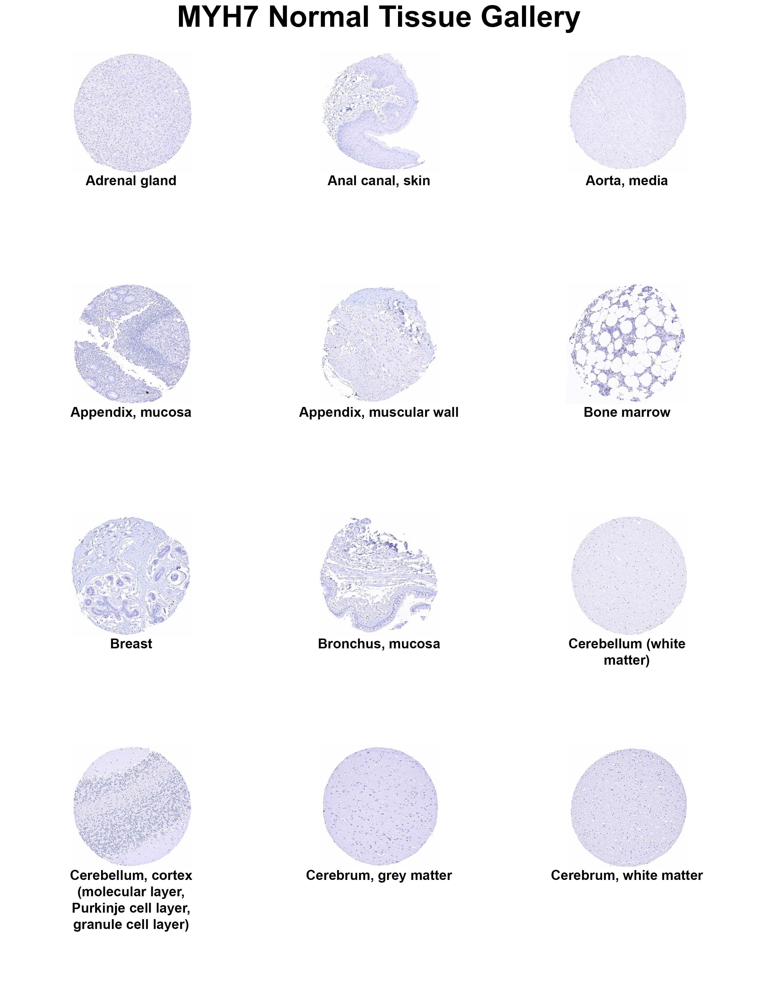 MYH7 Antibody (MSVA-464M) - Azide and BSA Free MYH7 Antibody (MSVA-464M) - Azide and BSA Free MYH7 Normal Tissue Gallery
