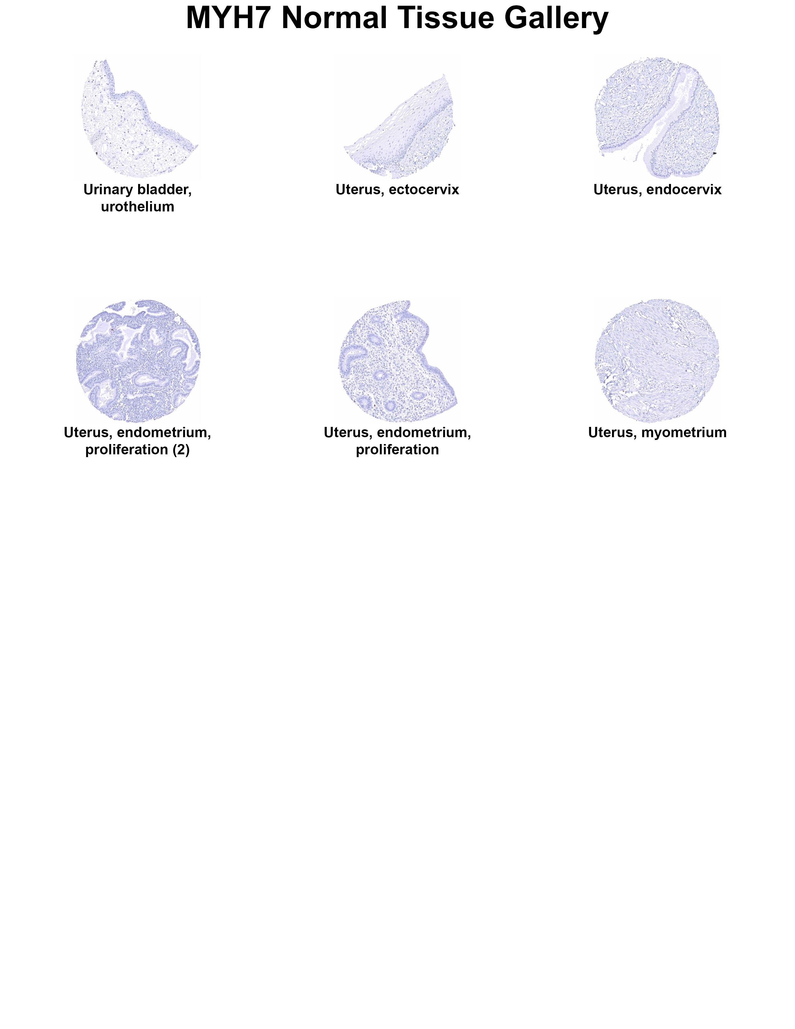 MYH7 Antibody (MSVA-464M) - Azide and BSA Free MYH7 Antibody (MSVA-464M) - Azide and BSA Free MYH7 Normal Tissue Gallery