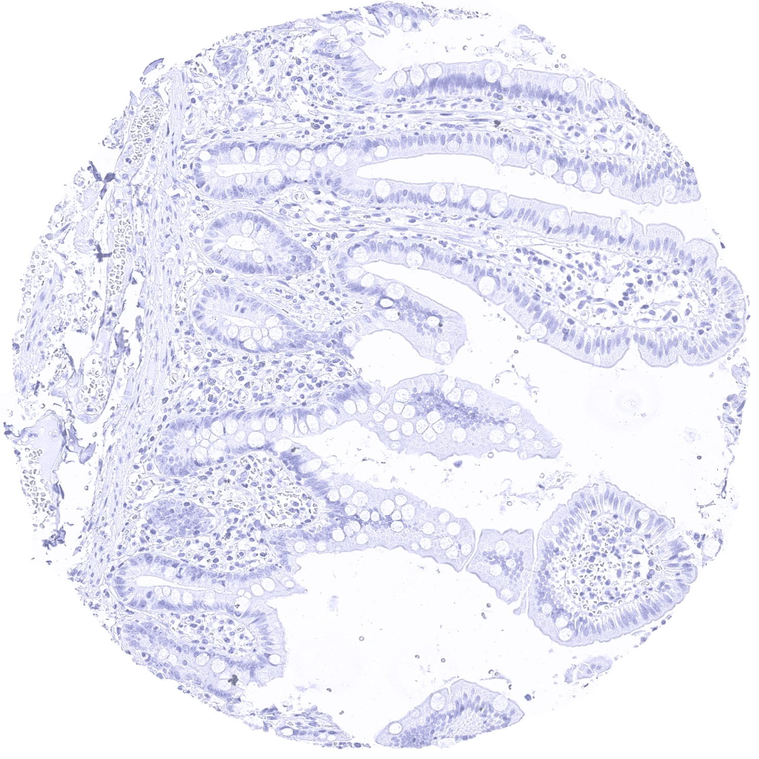 MYH7 Antibody (MSVA-464M) - Azide and BSA Free