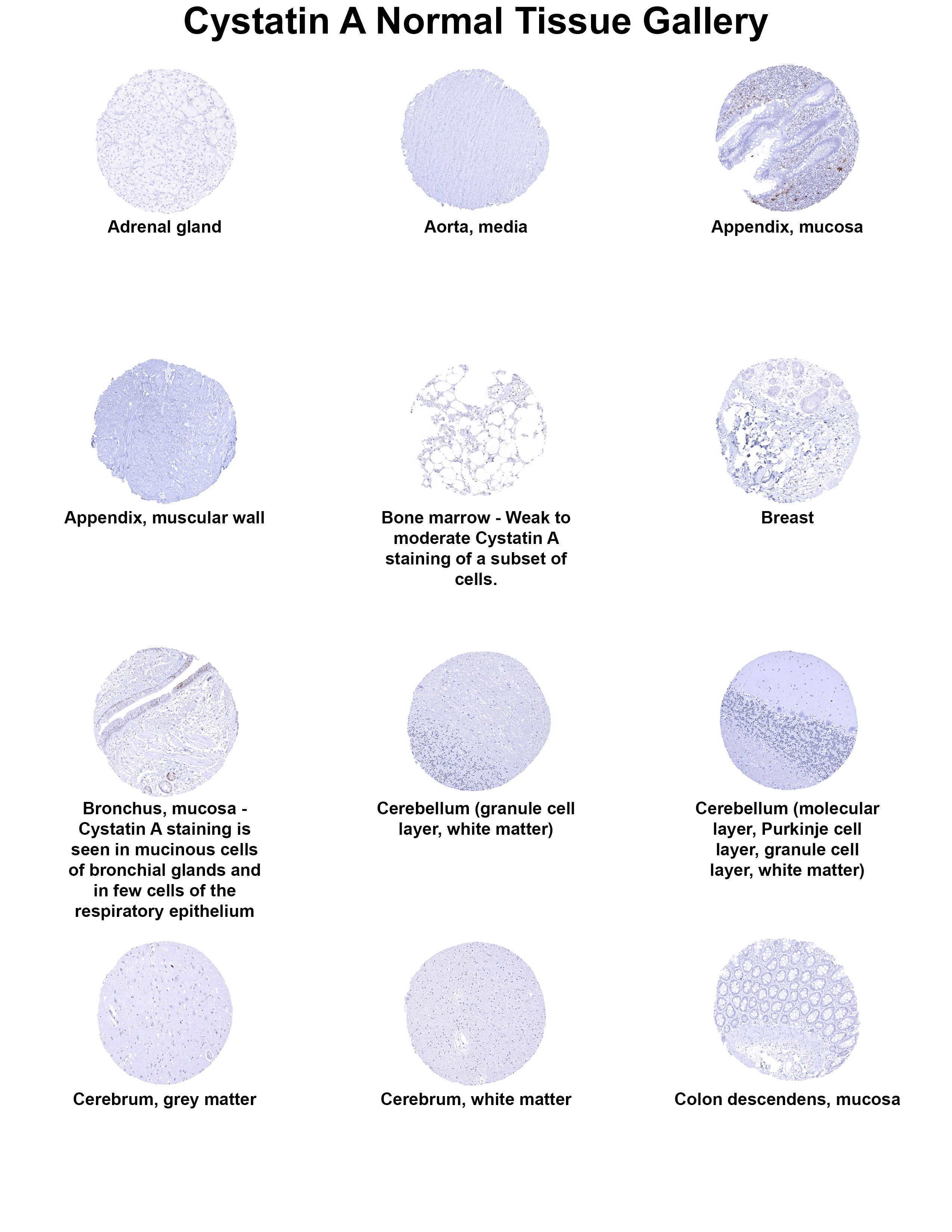 Cystatin A Antibody (MSVA-461M) - Azide and BSA Free Cystatin A Antibody (MSVA-461M) - Azide and BSA Free Cystatin A Normal Tissue Gallery