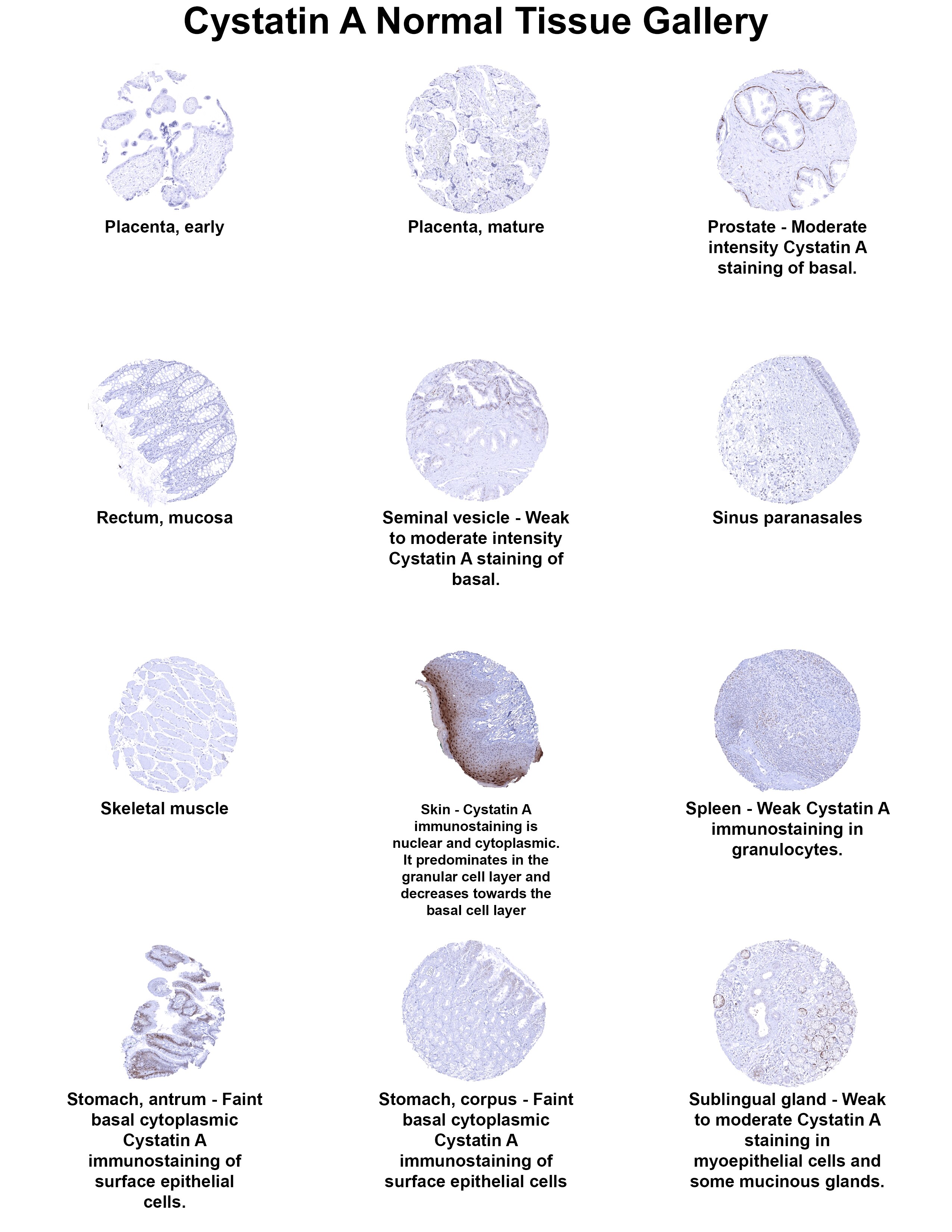 Cystatin A Antibody (MSVA-461M) - Azide and BSA Free Cystatin A Antibody (MSVA-461M) - Azide and BSA Free Cystatin A Normal Tissue Gallery