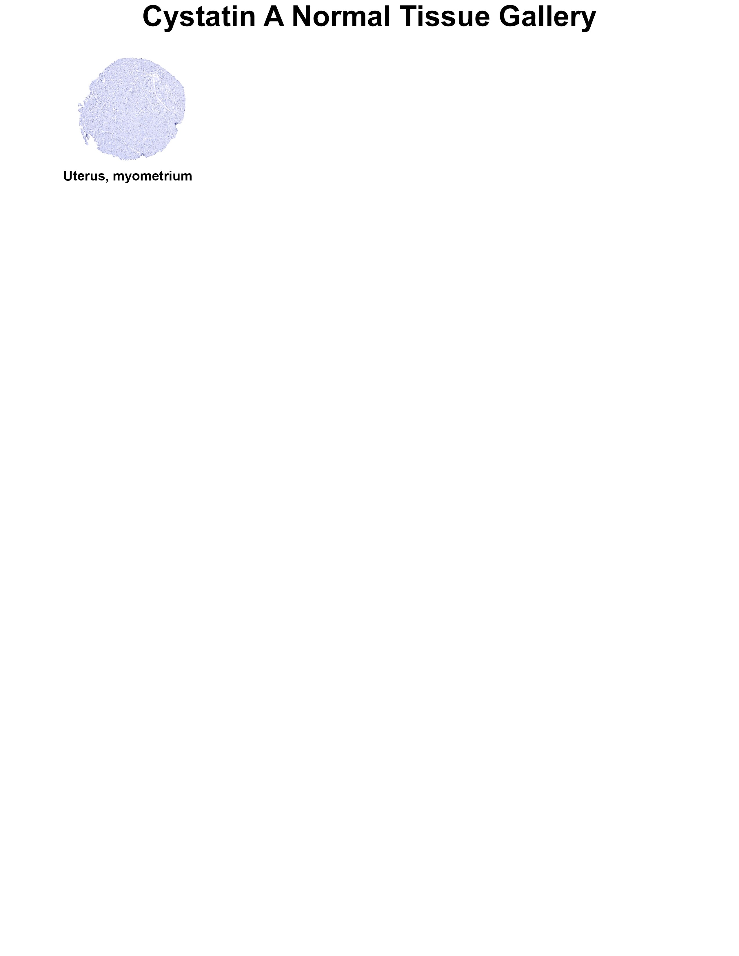 Cystatin A Antibody (MSVA-461M) - Azide and BSA Free Cystatin A Antibody (MSVA-461M) - Azide and BSA Free Cystatin A Normal Tissue Gallery