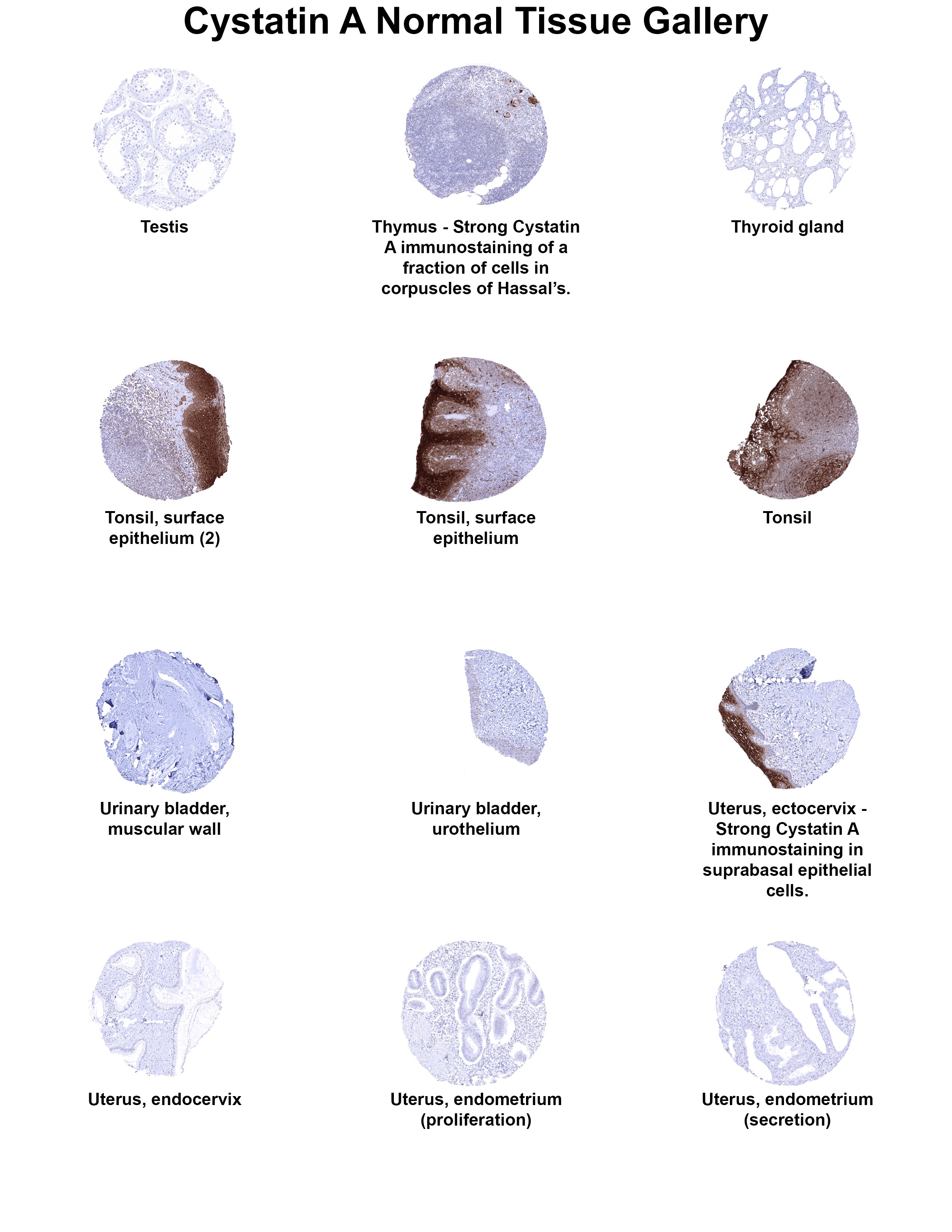 Cystatin A Antibody (MSVA-461M) - Azide and BSA Free Cystatin A Antibody (MSVA-461M) - Azide and BSA Free Cystatin A Normal Tissue Gallery