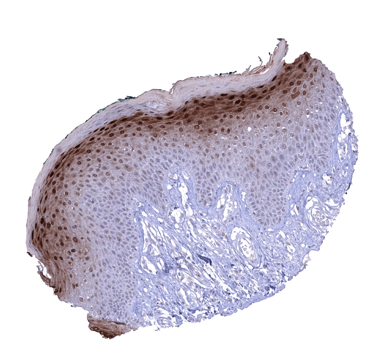 Cystatin A Antibody (MSVA-461M) - Azide and BSA Free