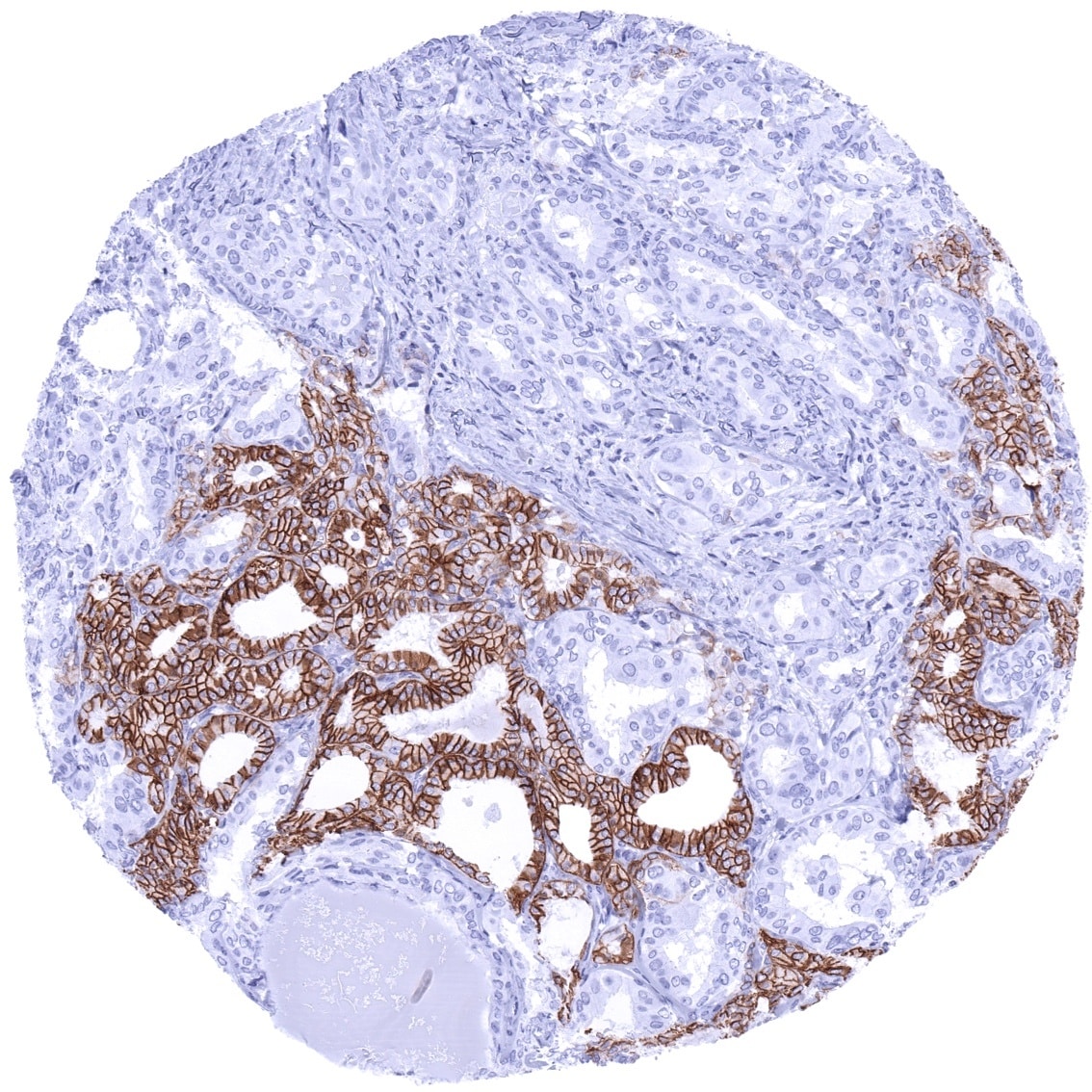 Cadherin-16 Antibody (MSVA-516R) - Azide and BSA Free