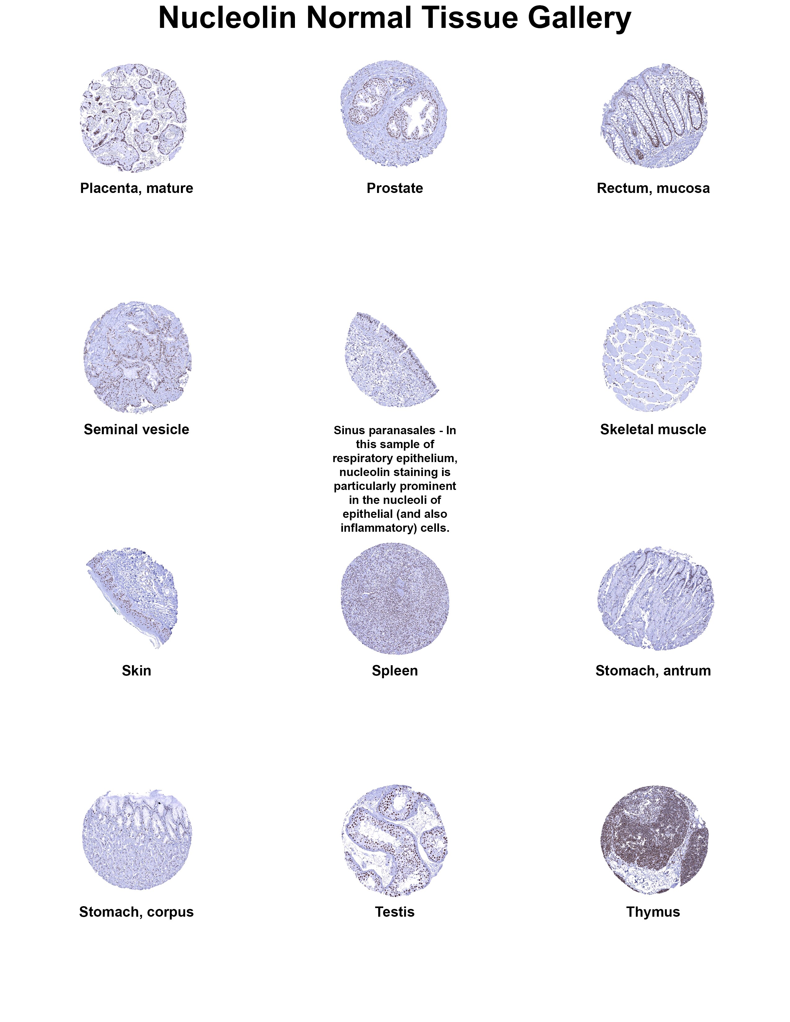 Nucleolin Antibody (MSVA-623R) - Azide and BSA Free Nucleolin Antibody (MSVA-623R) - Azide and BSA Free Nucleolin Normal Tissue Gallery