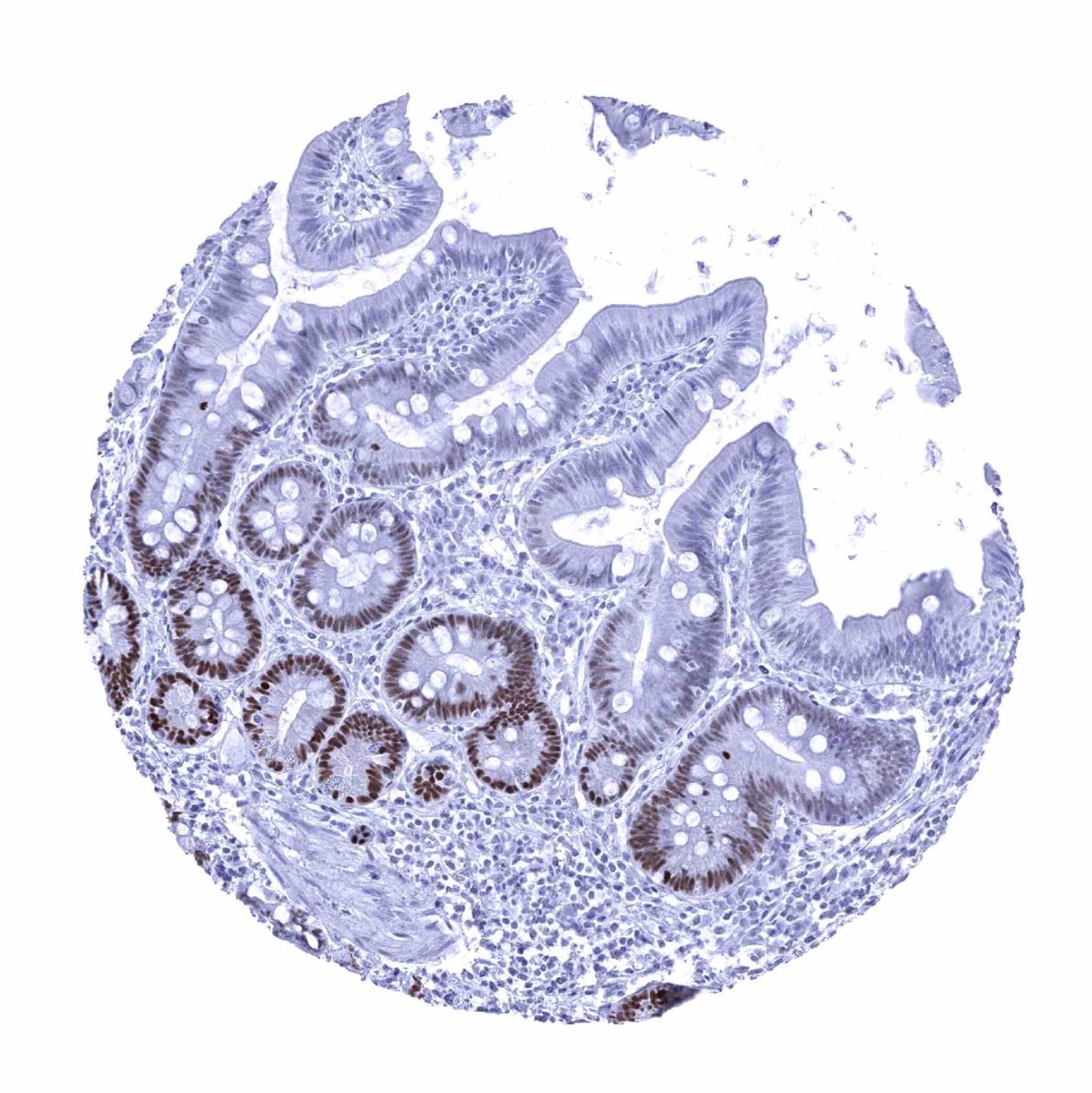 SOX9 Antibody (MSVA-709R) - Azide and BSA Free