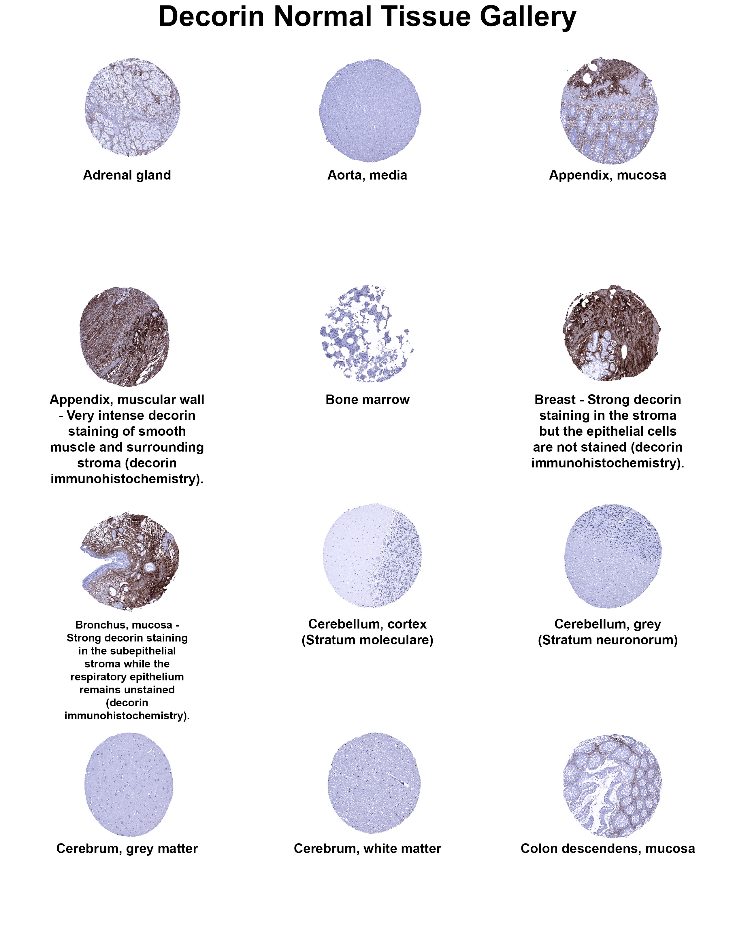 Decorin Antibody (MSVA-537R) - Azide and BSA Free Decorin Antibody (MSVA-537R) - Azide and BSA Free Decorin Normal Tissue Gallery