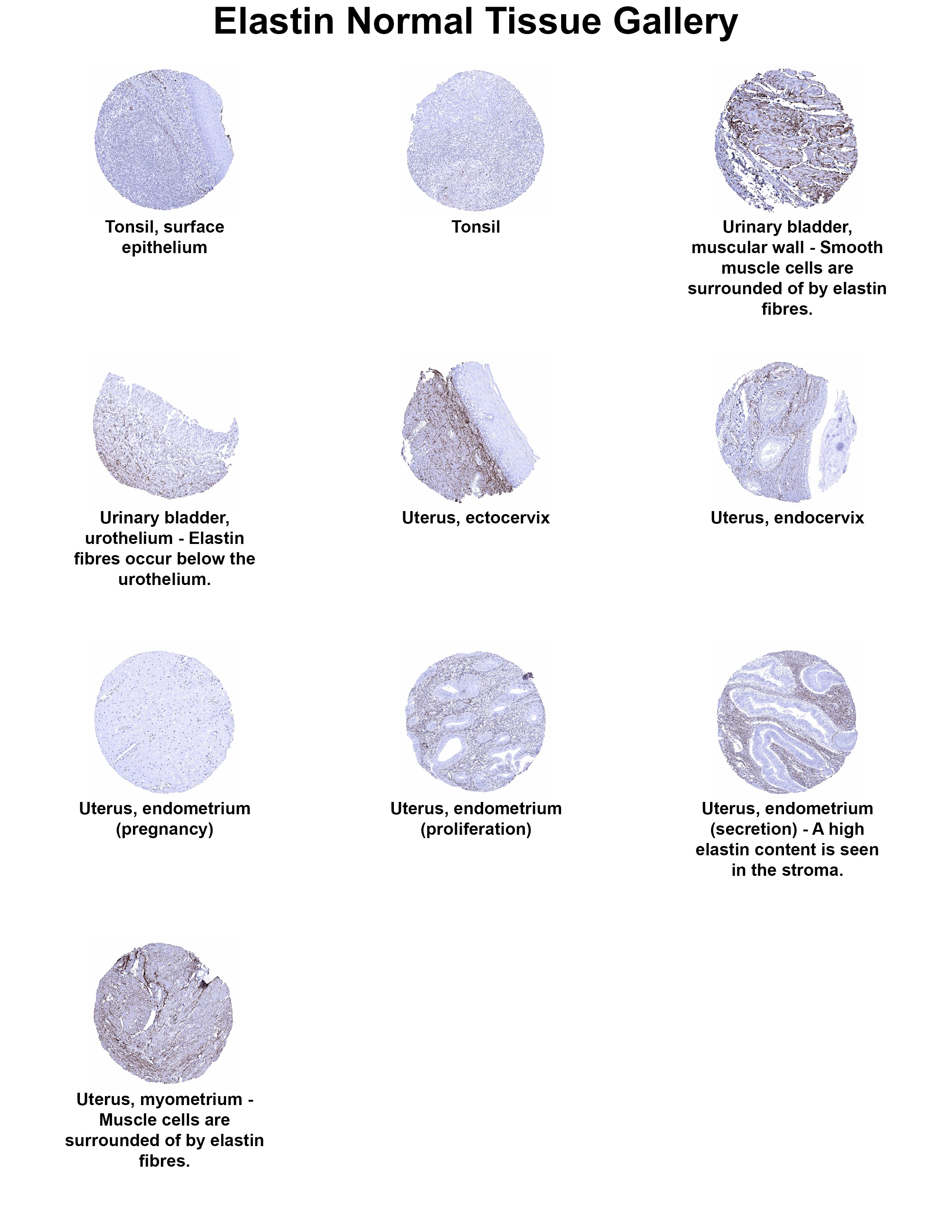 Elastin Antibody (MSVA-648R) - Azide and BSA Free Elastin Antibody (MSVA-648R) - Azide and BSA Free Elastin Normal Tissue Gallery
