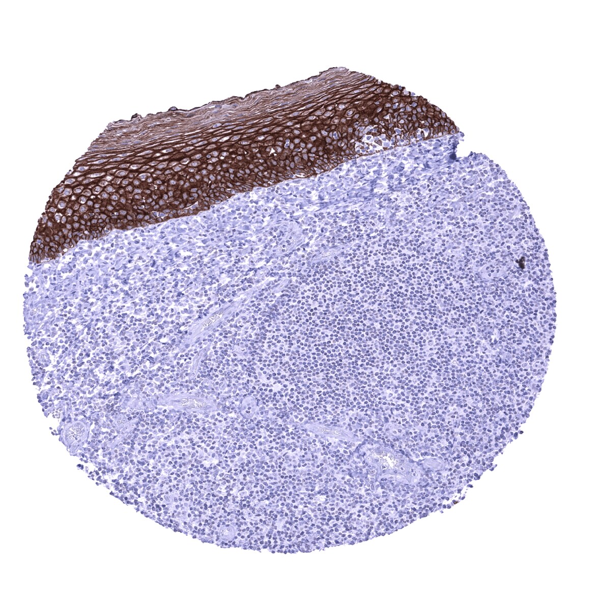 TRIM29 Antibody (MSVA-629M) - Azide and BSA Free