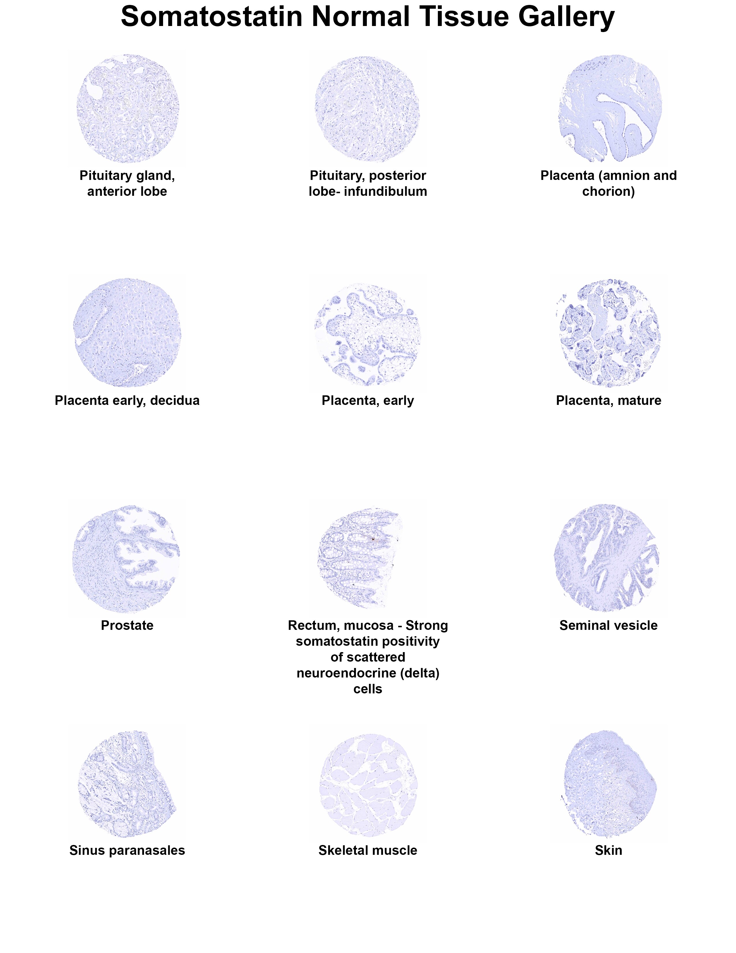 Somatostatin Antibody (MSVA-638R) - Azide and BSA Free Somatostatin Antibody (MSVA-638R) - Azide and BSA Free Somatostatin Normal Tissue Gallery