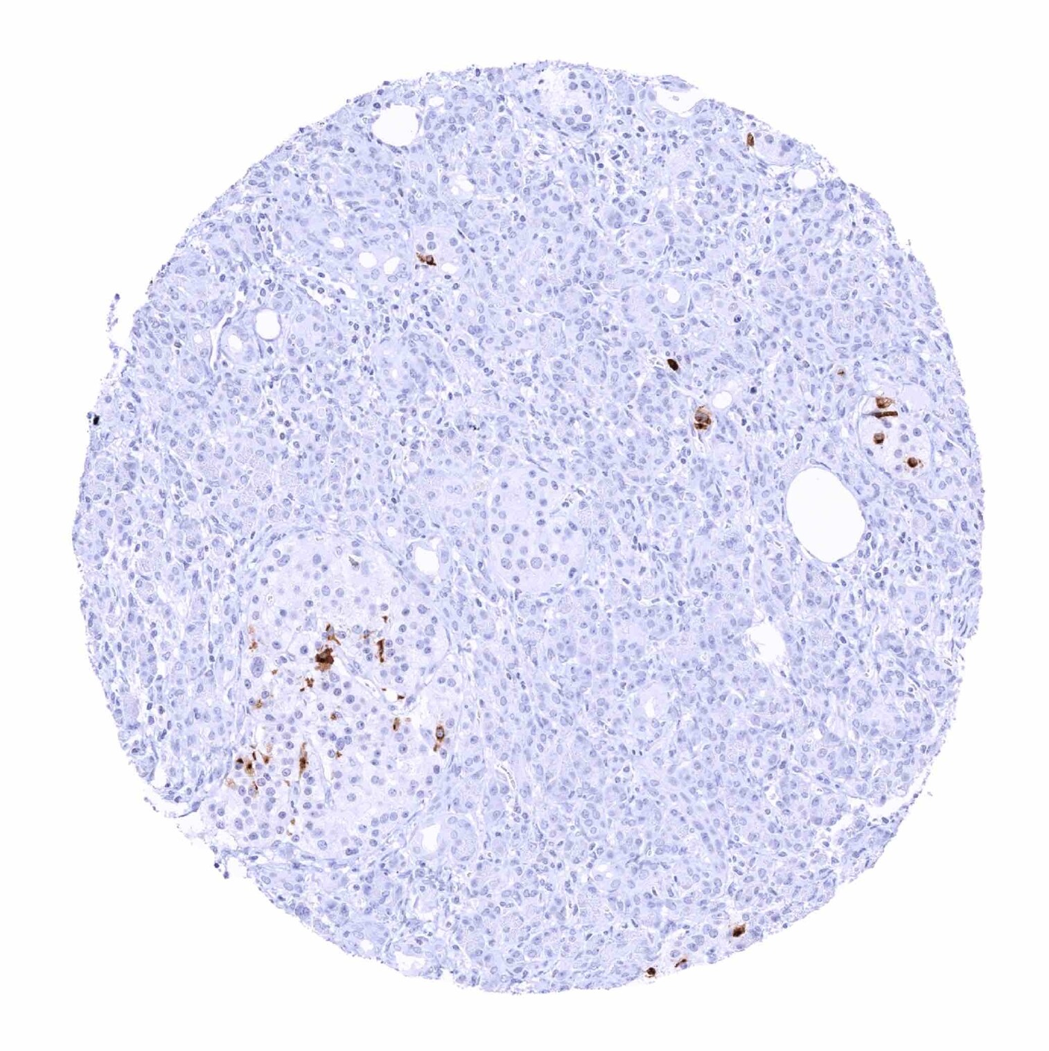 Somatostatin Antibody (MSVA-638R) - Azide and BSA Free