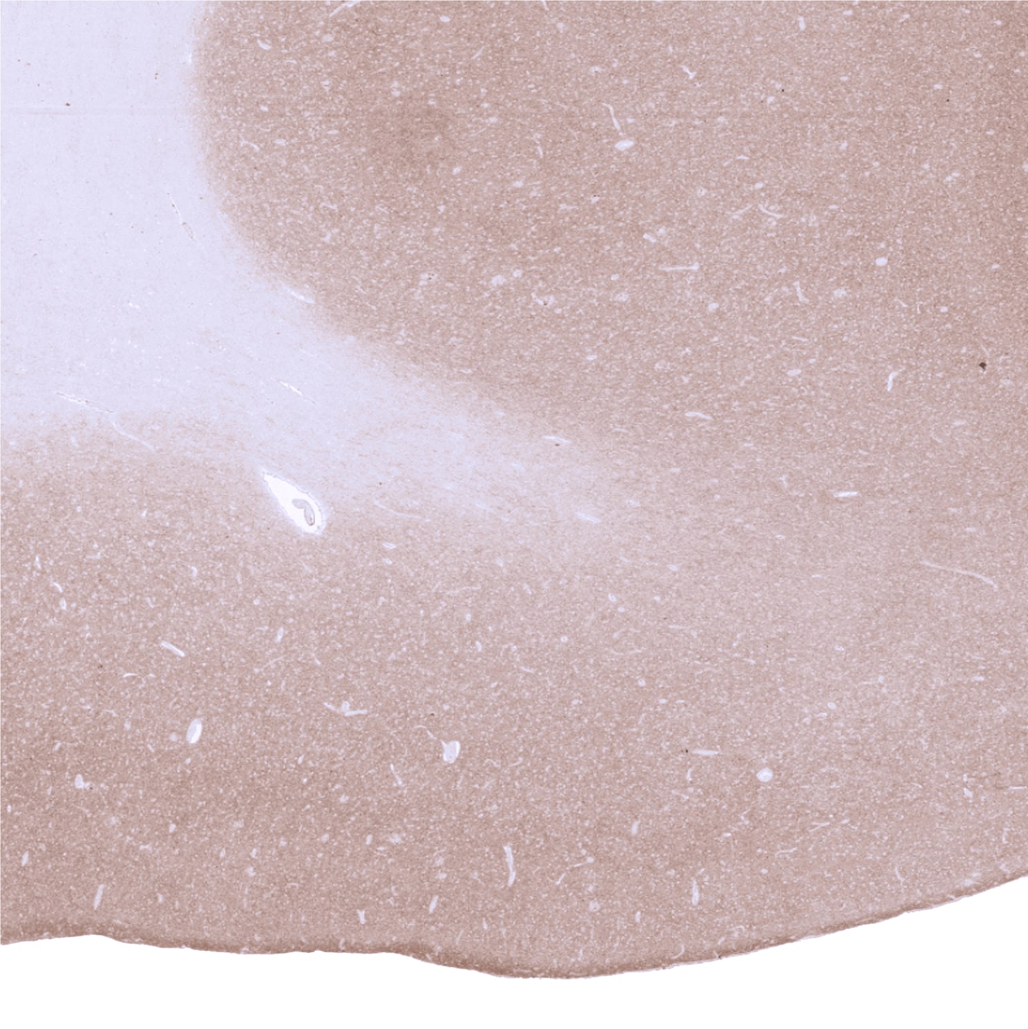 GAD2/GAD65 Antibody (MSVA-602M) - Azide and BSA Free