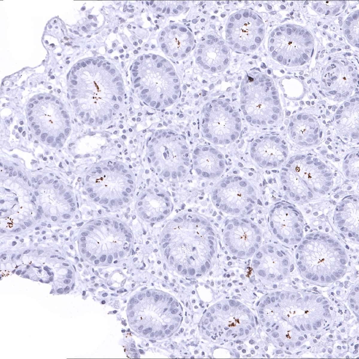 Helicobacter Pylori Antibody (MSVA-466M) - Azide and BSA Free