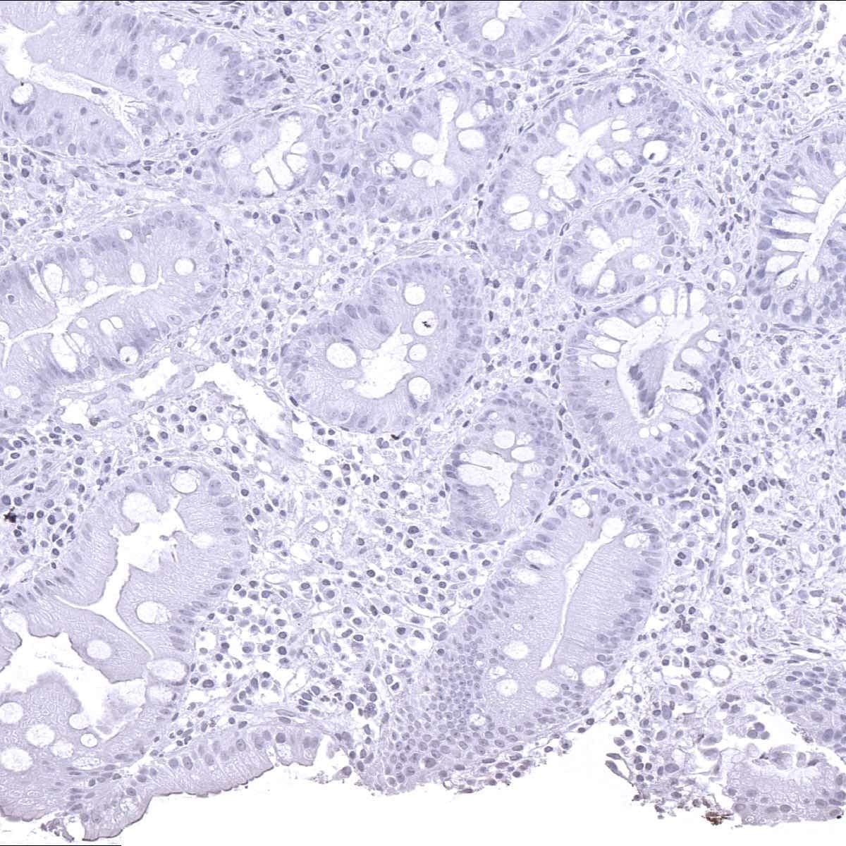 Helicobacter Pylori Antibody (MSVA-466M) - Azide and BSA Free