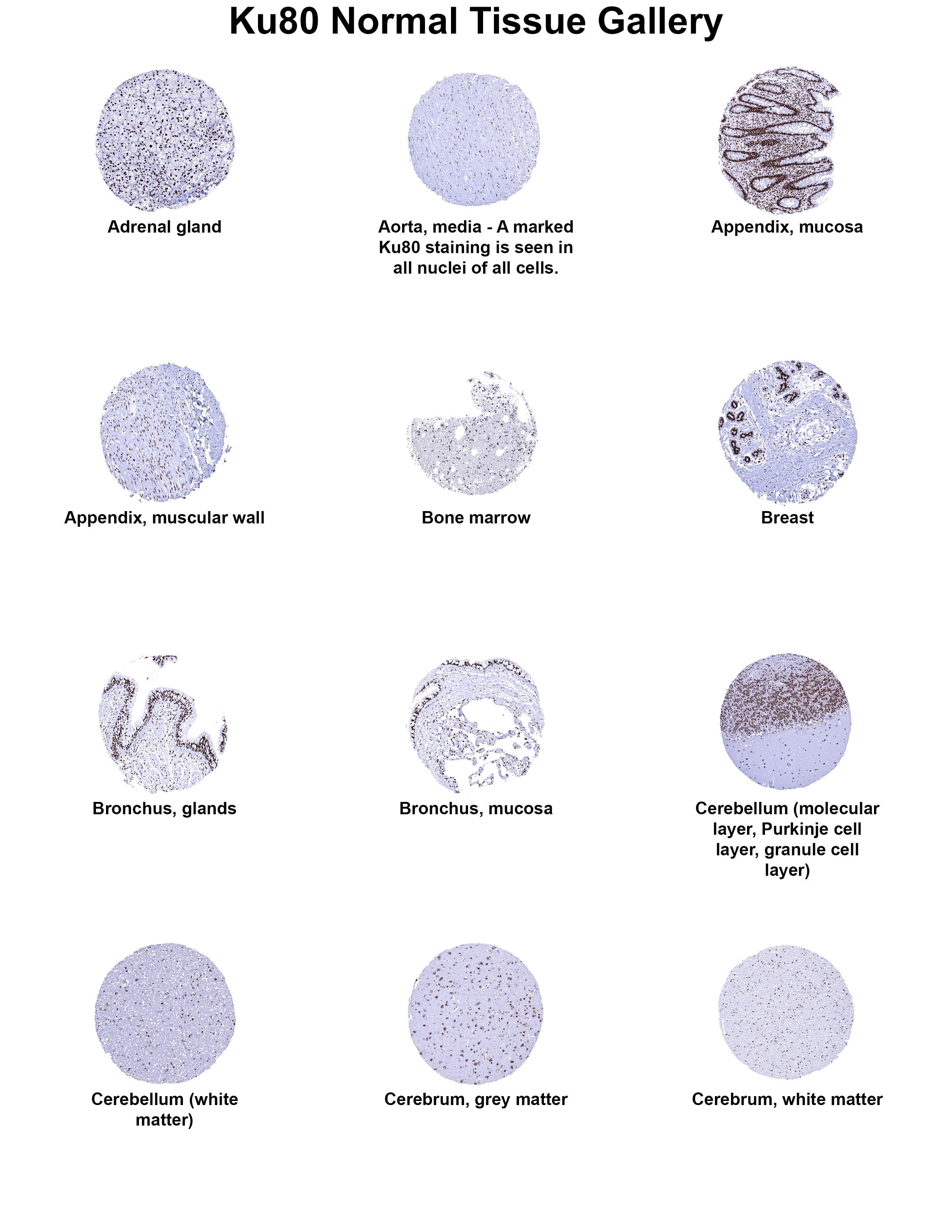 Ku80/XRCC5 Antibody (MSVA-880M) - Azide and BSA Free Ku80/XRCC5 Antibody (MSVA-880M) - Azide and BSA Free Ku80/XRCC5 Normal Tissue Gallery