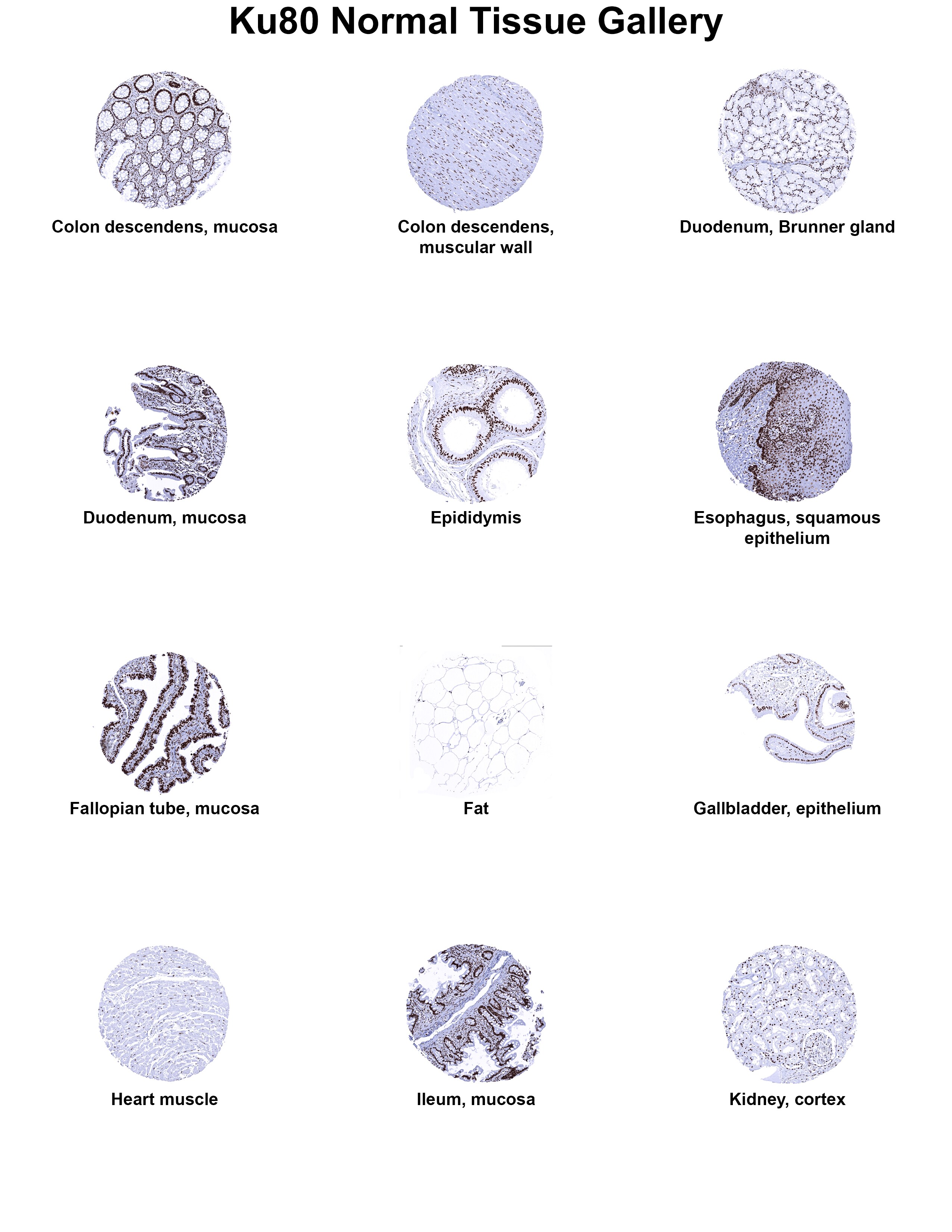 Ku80/XRCC5 Antibody (MSVA-880M) - Azide and BSA Free Ku80/XRCC5 Antibody (MSVA-880M) - Azide and BSA Free Ku80/XRCC5 Normal Tissue Gallery