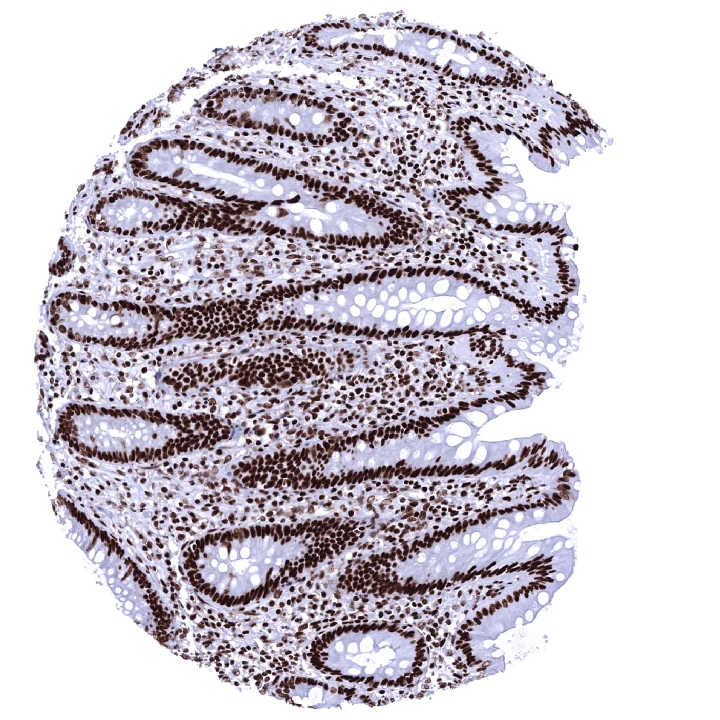 Ku80/XRCC5 Antibody (MSVA-880M) - Azide and BSA Free