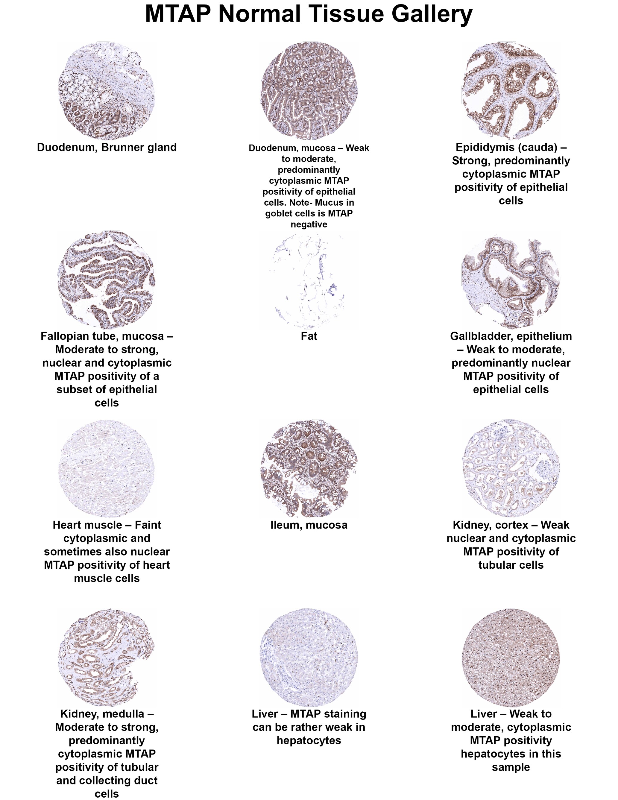 MTAP Antibody (MSVA-741R) - Azide and BSA Free MTAP Antibody (MSVA-741R) - Azide and BSA Free MTAP Normal Tissue Gallery