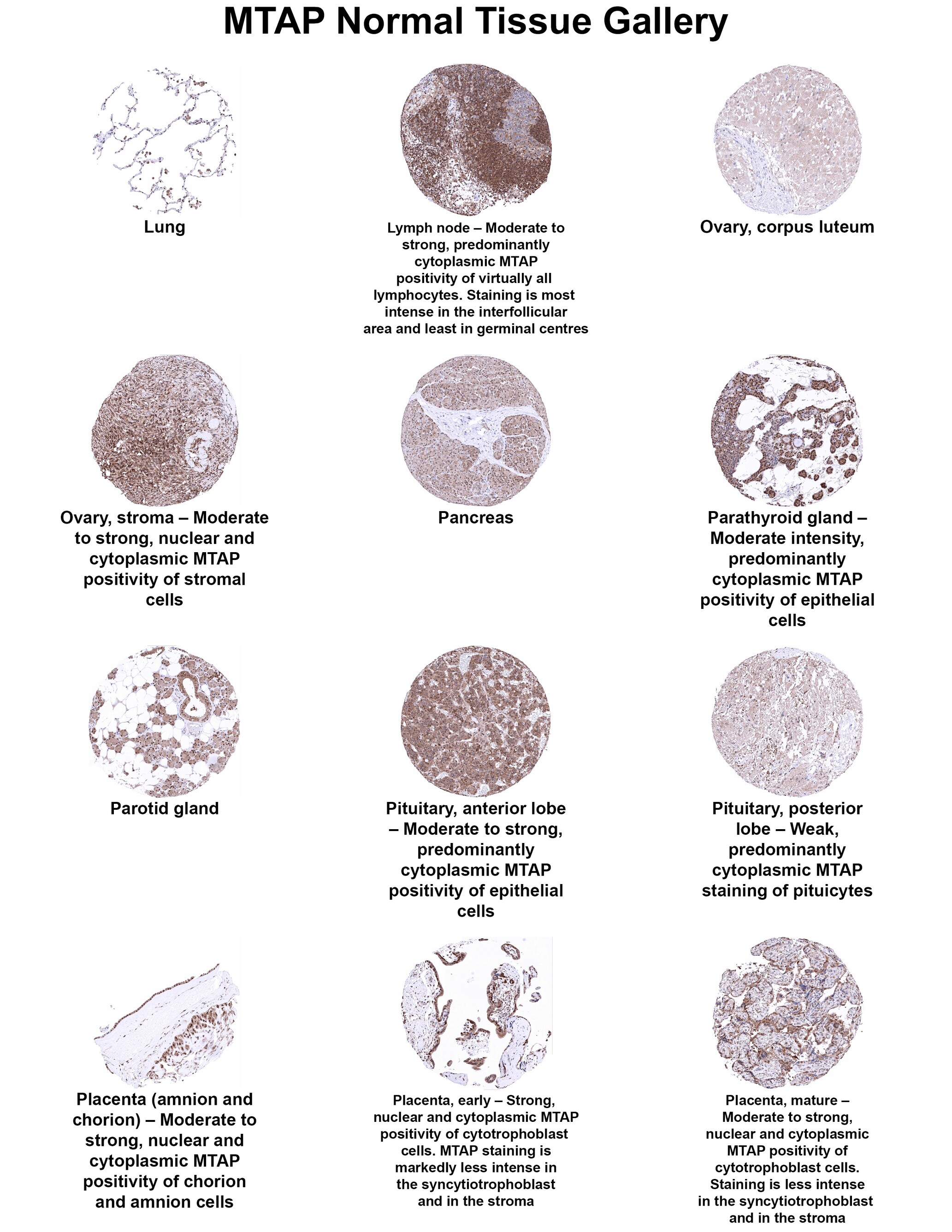 MTAP Antibody (MSVA-741R) - Azide and BSA Free MTAP Antibody (MSVA-741R) - Azide and BSA Free MTAP Normal Tissue Gallery