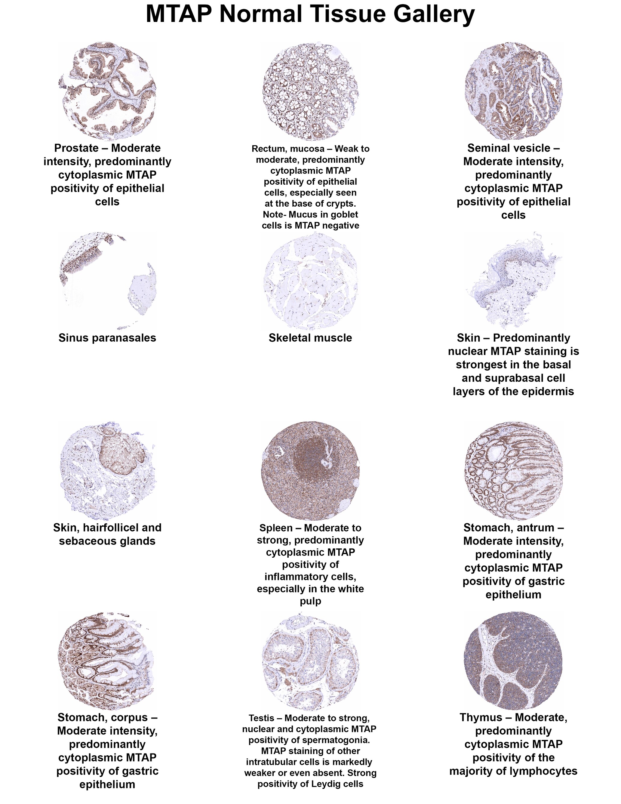 MTAP Antibody (MSVA-741R) - Azide and BSA Free MTAP Antibody (MSVA-741R) - Azide and BSA Free MTAP Normal Tissue Gallery