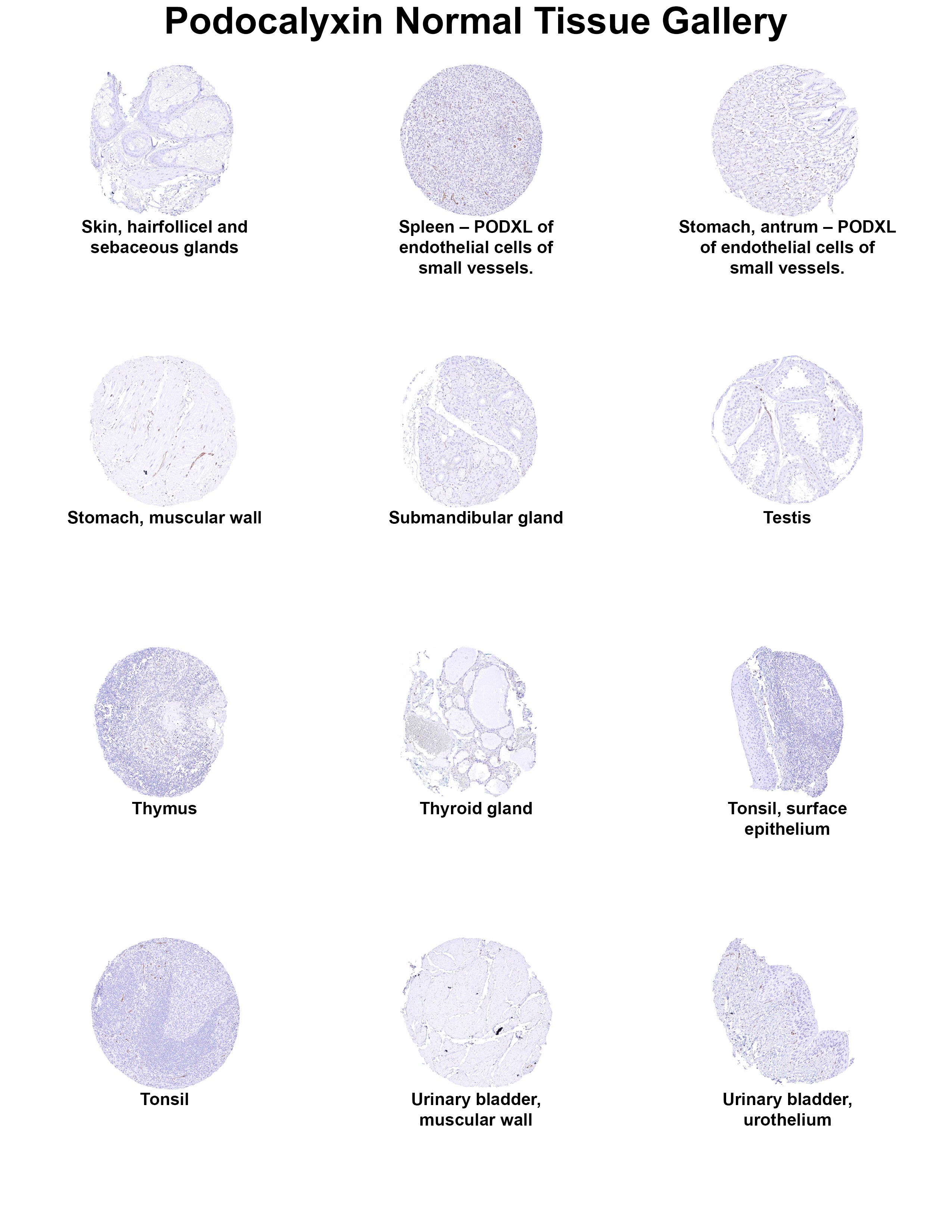 Podocalyxin Like Antibody (MSVA-645M) - Azide and BSA Free Podocalyxin Like Antibody (MSVA-645M) - Azide and BSA Free Podocalyxin Like Normal Tissue Gallery