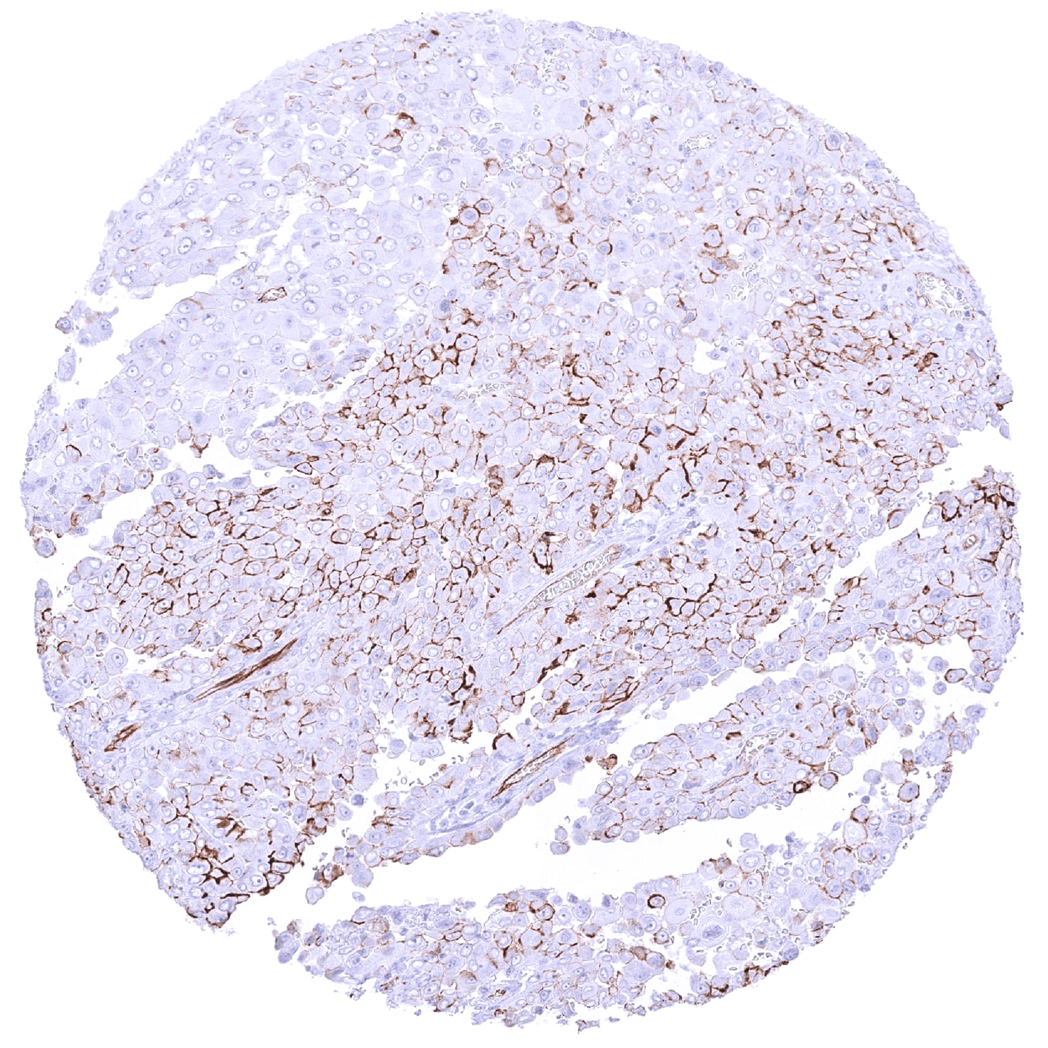 Podocalyxin Like Antibody (MSVA-645M) - Azide and BSA Free