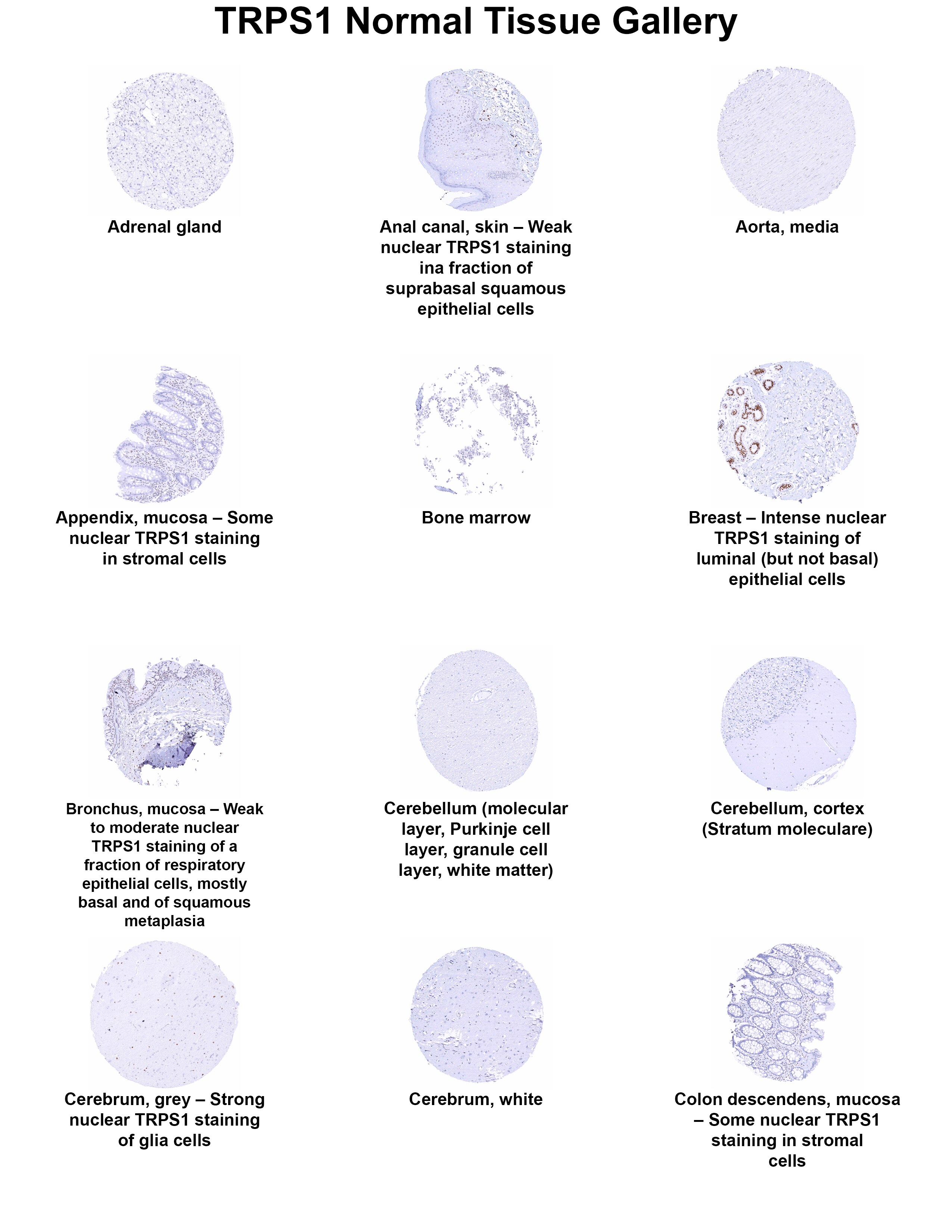 TRPS1 Antibody (MSVA-512R) - Azide and BSA Free TRPS1 Antibody (MSVA-512R) - Azide and BSA Free TRPS1 Normal Tissue Gallery