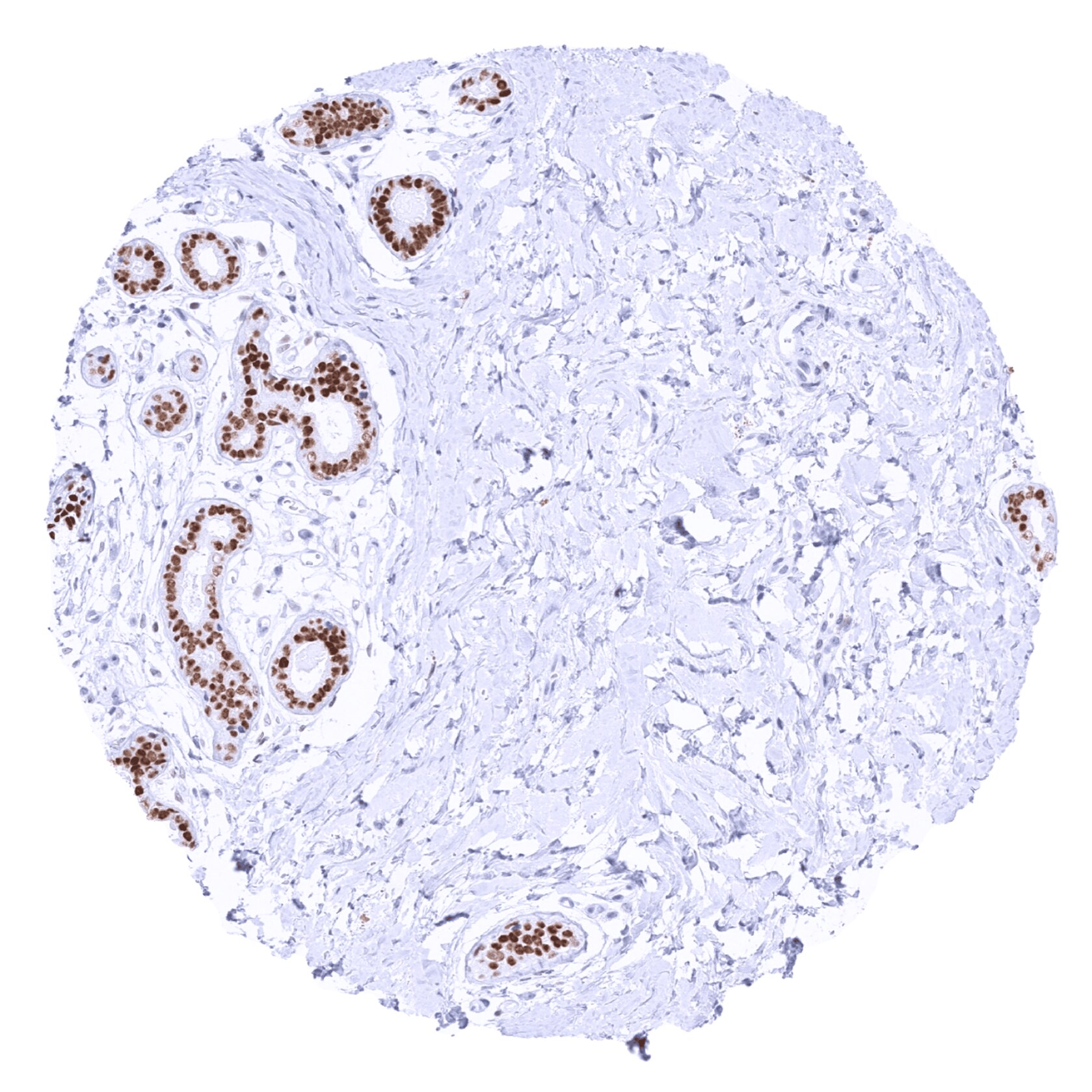 TRPS1 Antibody (MSVA-512R) - Azide and BSA Free