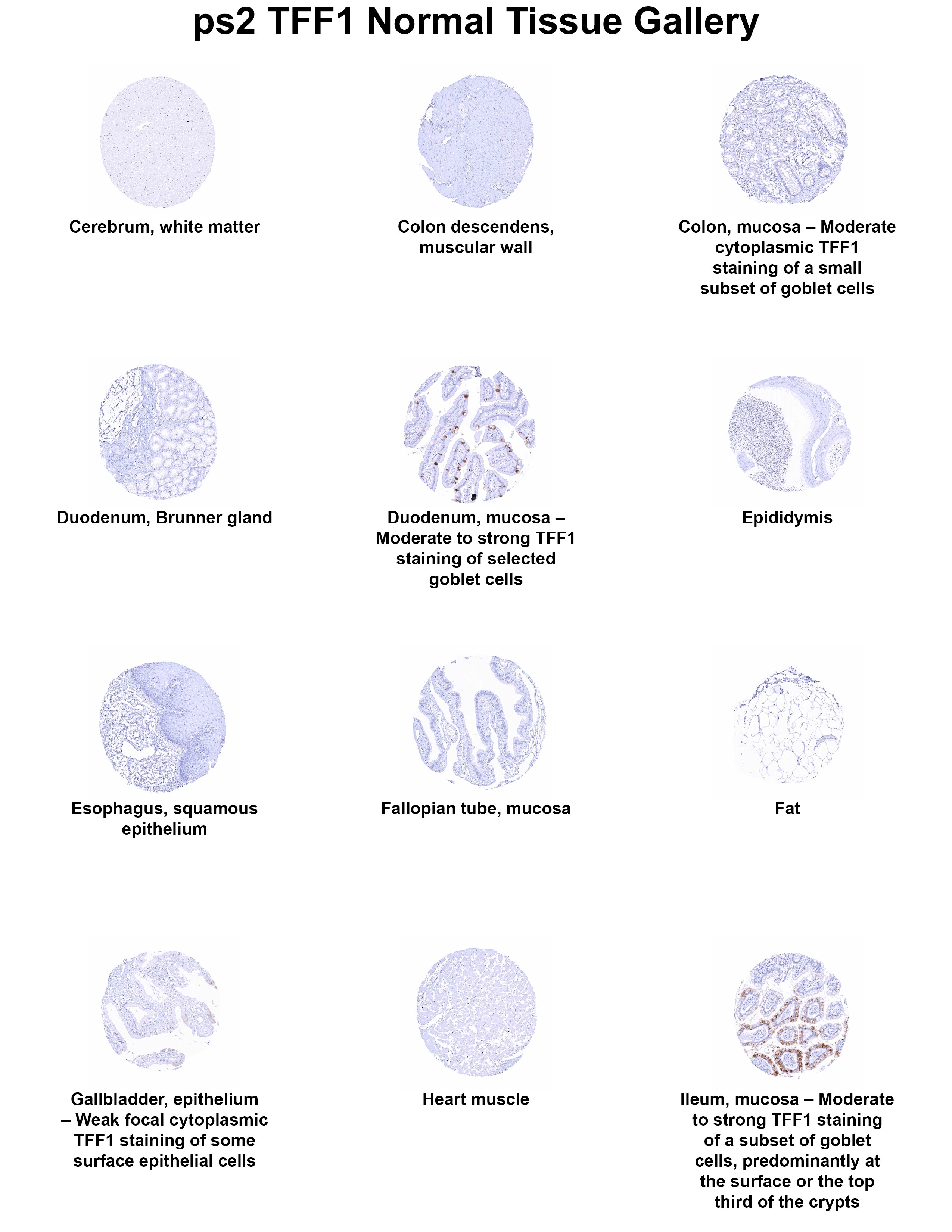TFF1/pS2 Antibody (MSVA-482M) - Azide and BSA Free TFF1/pS2 Antibody (MSVA-482M) - Azide and BSA Free TFF1/pS2 Normal Tissue Gallery