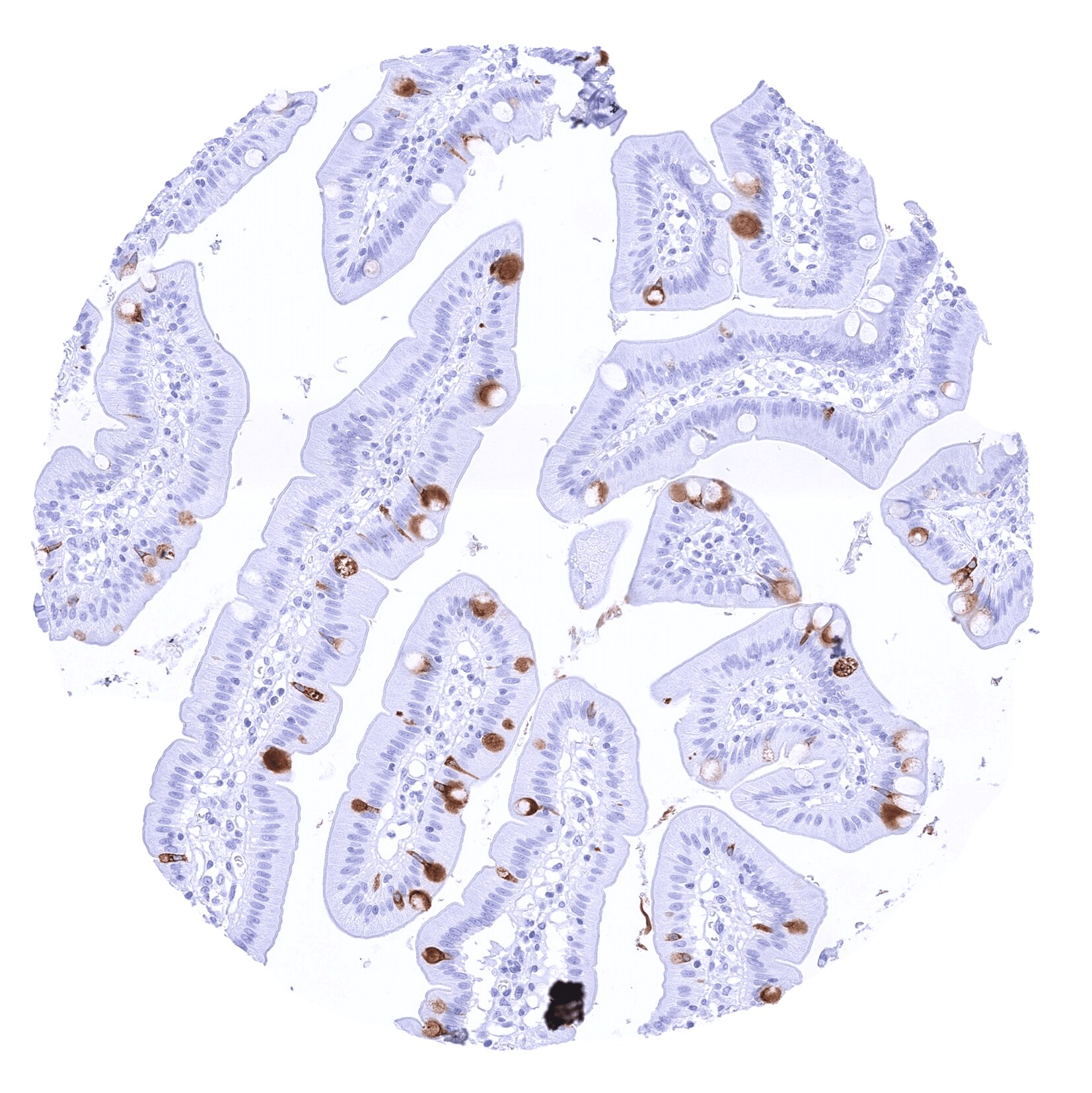 TFF1/pS2 Antibody (MSVA-482M) - Azide and BSA Free