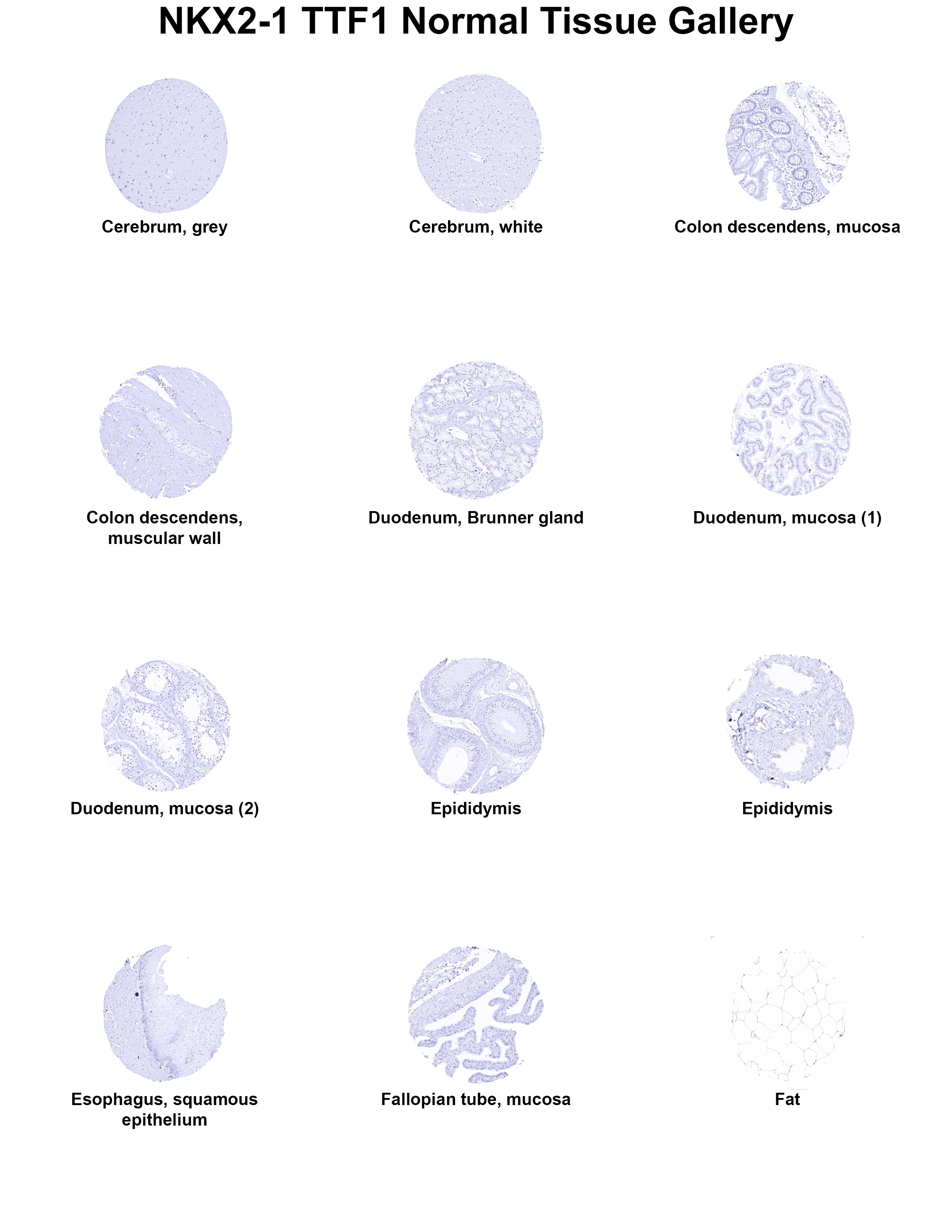 TTF-1 / NKX2-1 Antibody (MSVA-312R) - Azide and BSA Free TTF-1 / NKX2-1 Antibody (MSVA-312R) - Azide and BSA Free TTF-1 / NKX2-1 Normal Tissue Gallery