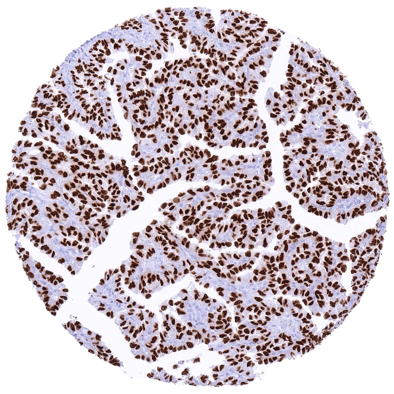 TTF-1 / NKX2-1 Antibody (MSVA-312R) - Azide and BSA Free
