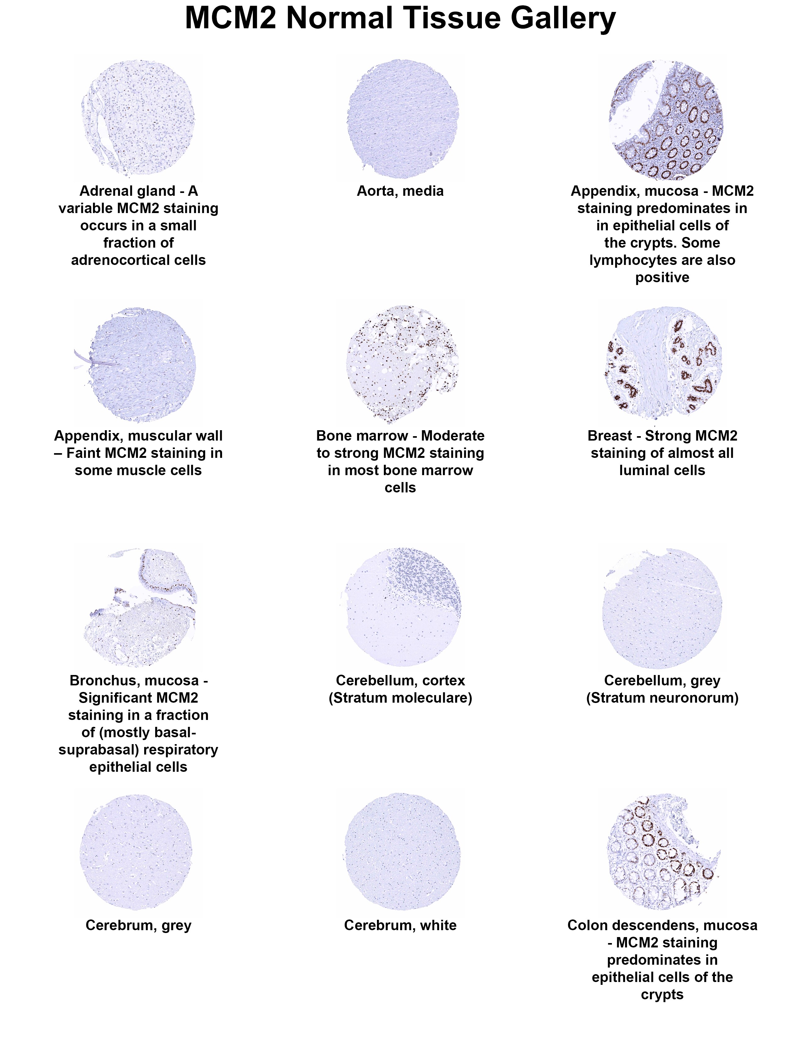 MCM2 Antibody (MSVA-502R) - Azide and BSA Free MCM2 Antibody (MSVA-502R) - Azide and BSA Free MCM2 Normal Tissue Gallery