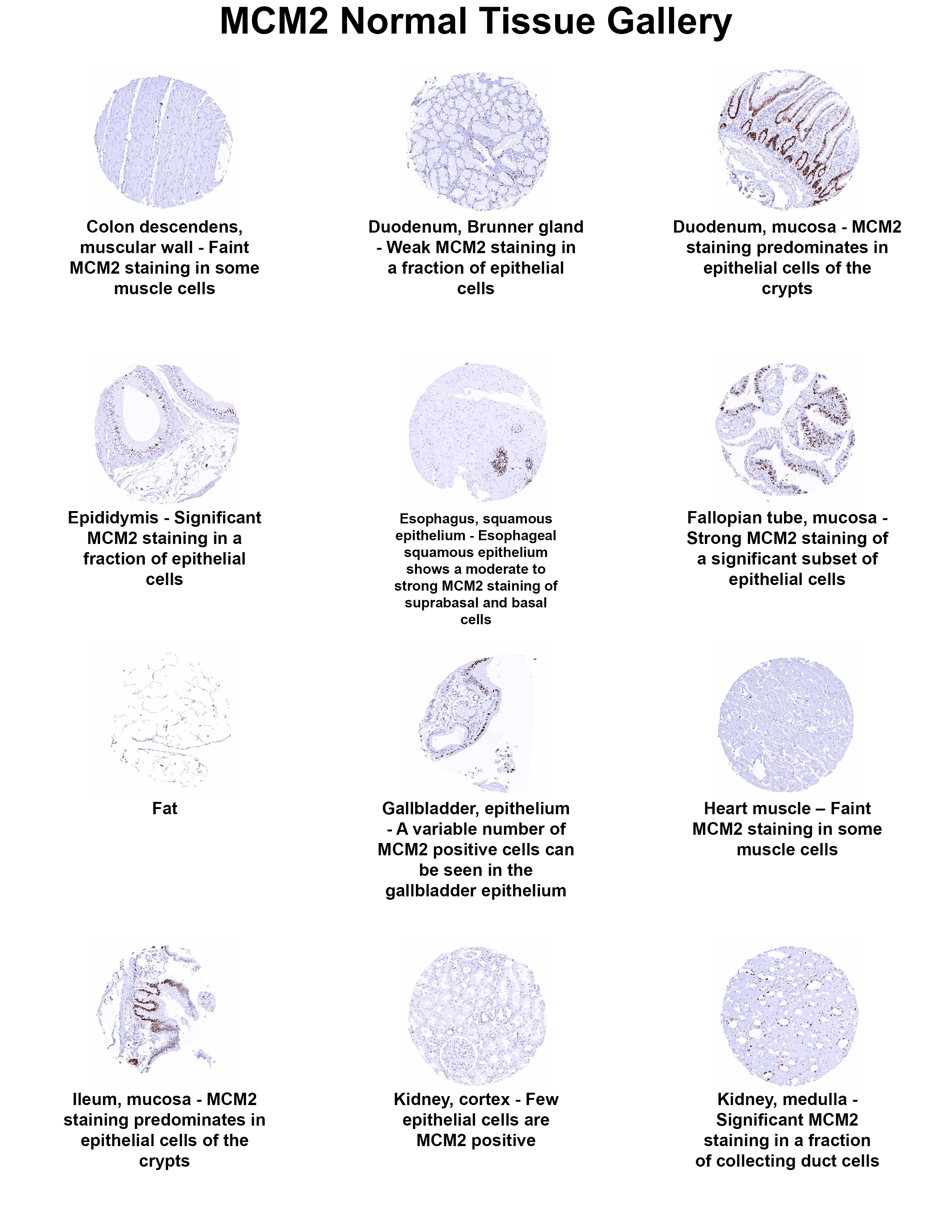 MCM2 Antibody (MSVA-502R) - Azide and BSA Free MCM2 Antibody (MSVA-502R) - Azide and BSA Free MCM2 Normal Tissue Gallery