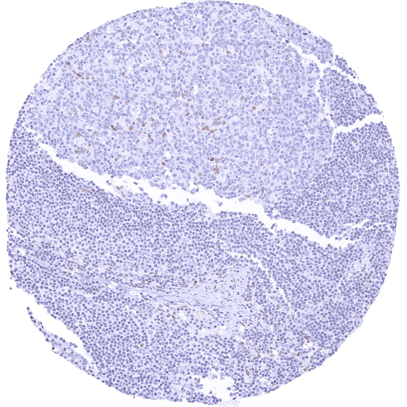 TLE1 Antibody (MSVA-856R) - Azide and BSA Free