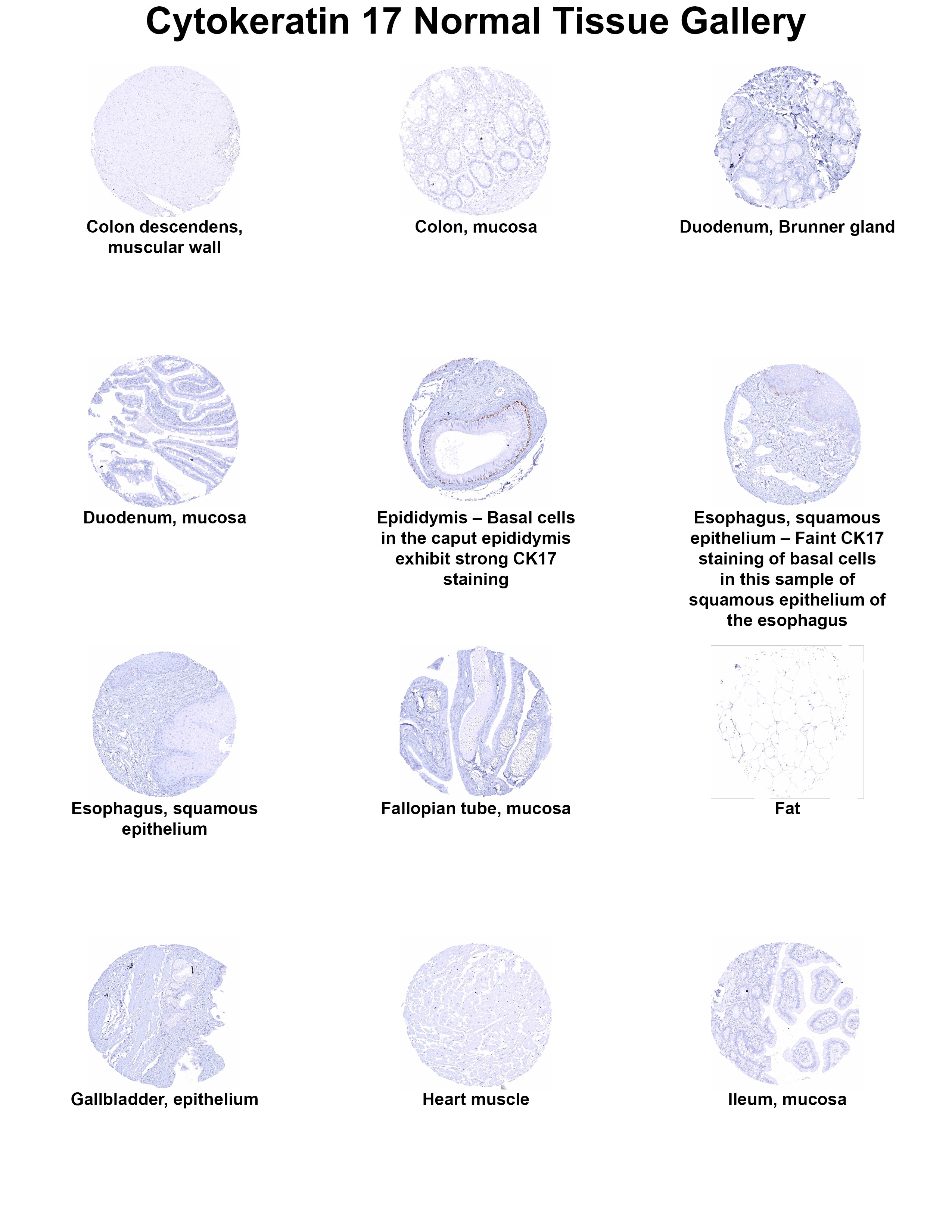 Cytokeratin 17 Antibody (MSVA-117R) - Azide and BSA Free Cytokeratin 17 Antibody (MSVA-117R) - Azide and BSA Free Cytokeratin 17 Normal Tissue Gallery