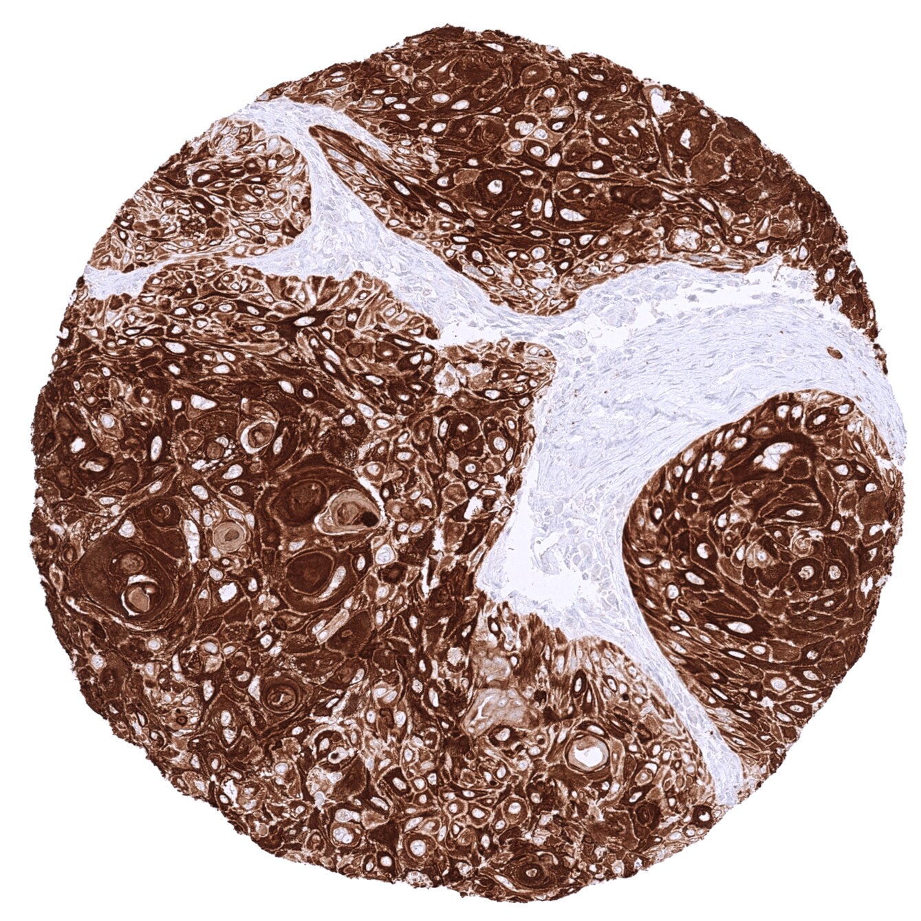 Cytokeratin 17 Antibody (MSVA-117R) - Azide and BSA Free