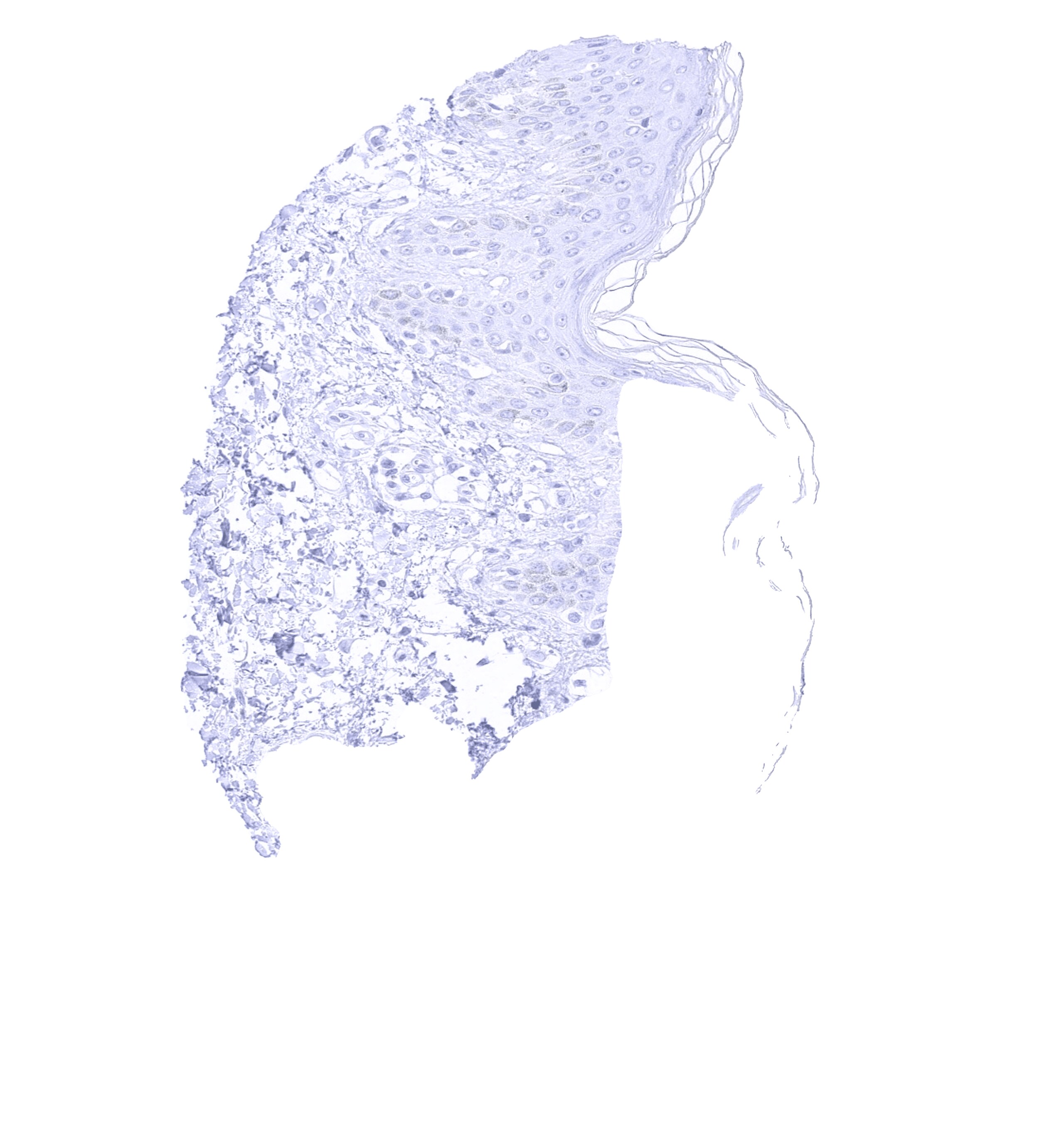 Cytokeratin 17 Antibody (MSVA-117R) - Azide and BSA Free