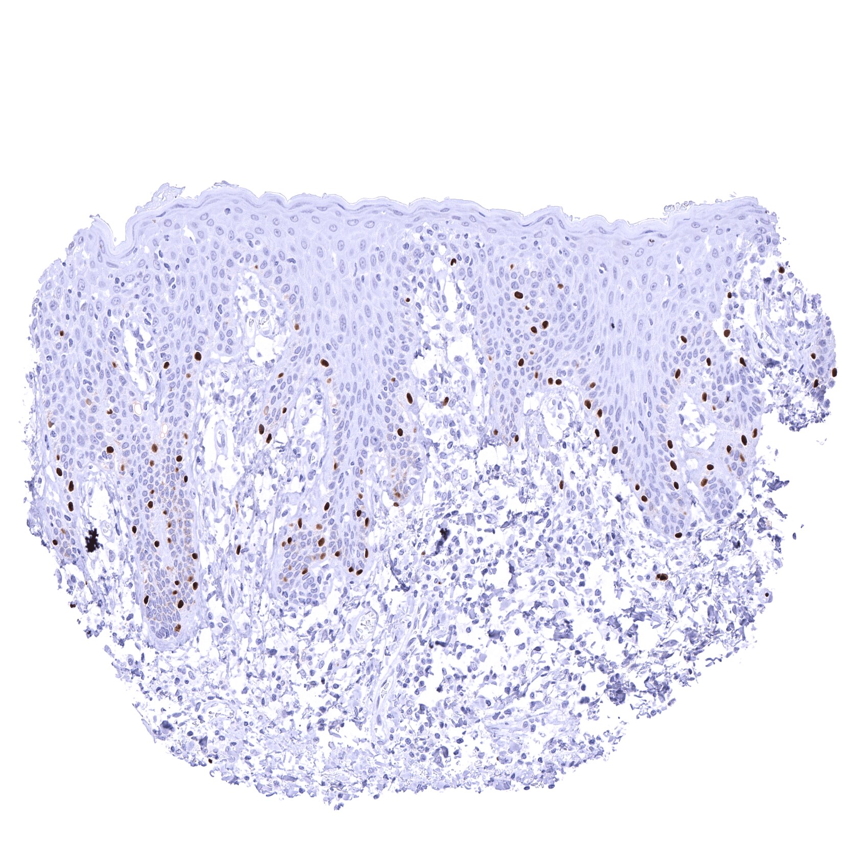 SOX10 Antibody (MSVA-710R) - Azide and BSA Free